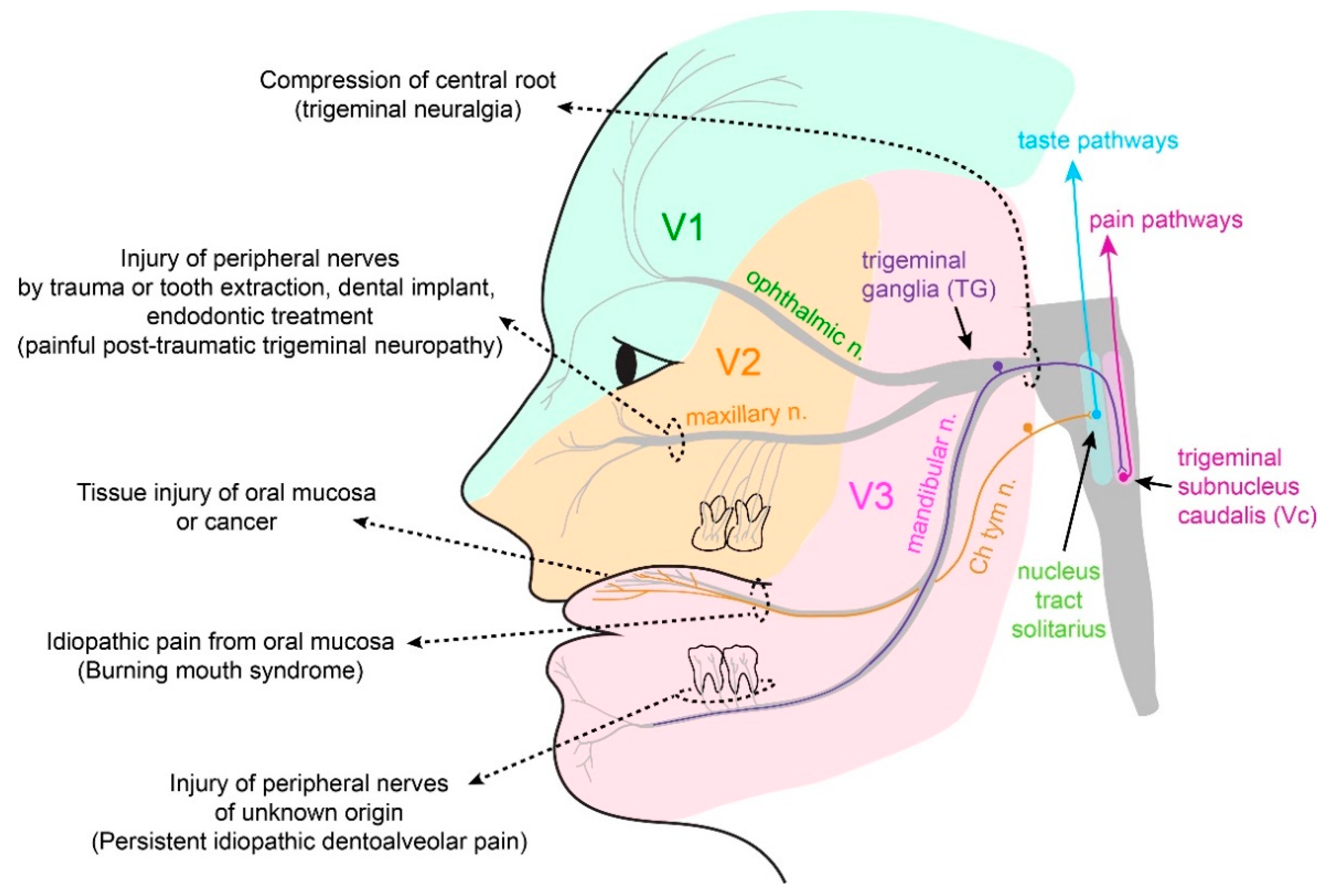 IJMS Free Full-Text Acute and Chronic Pain from Facial Skin and Oral Mucosa Unique Neurobiology and Challenging Treatment