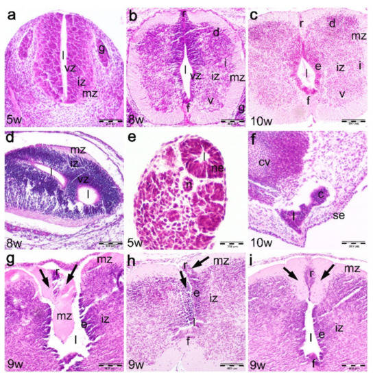 Expression Pattern of 5-HT (Serotonin) Receptors during