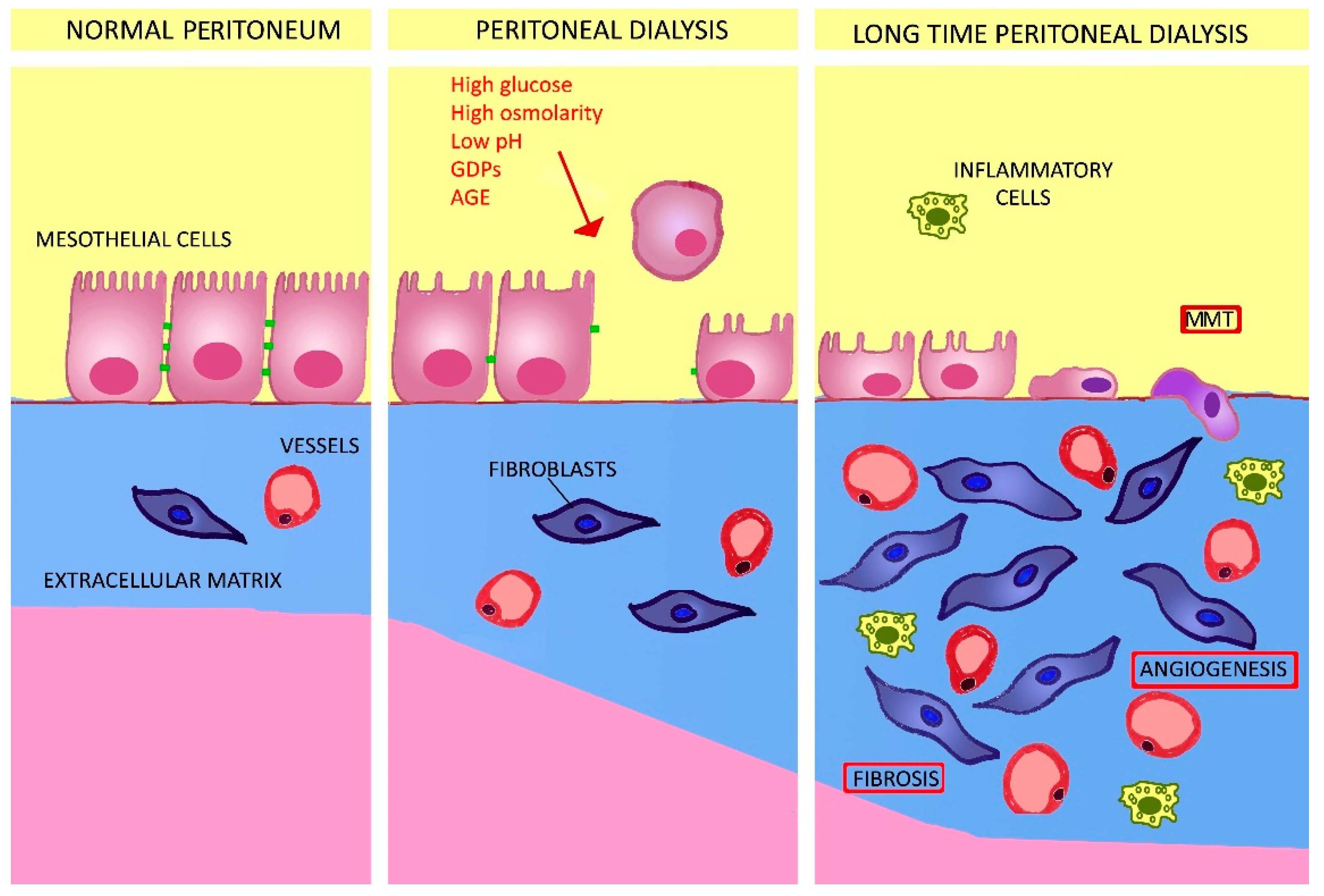 ijms-free-full-text-how-to-improve-the-biocompatibility-of