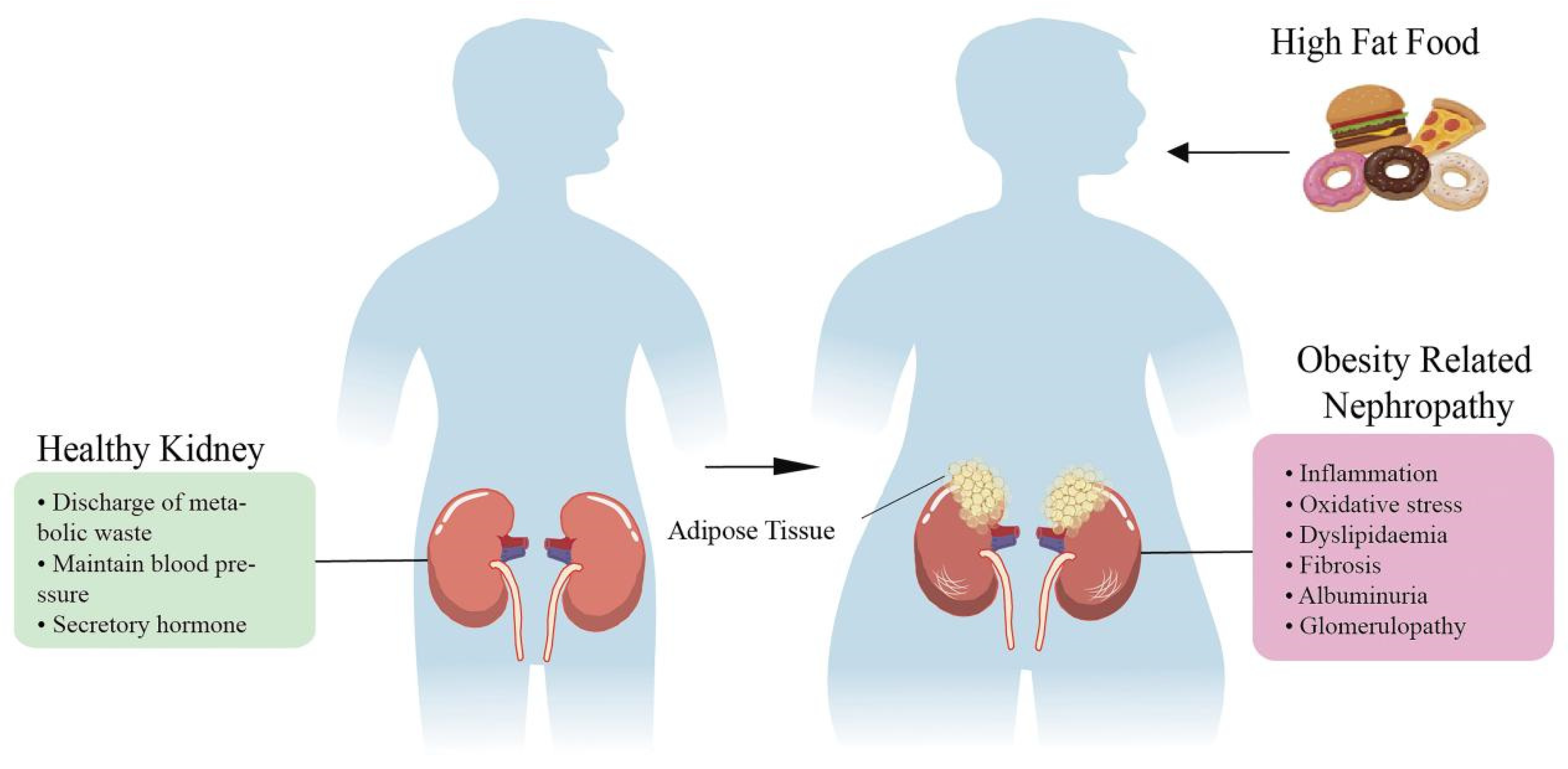 IJMS | Free Full-Text | Kidney Damage Caused by Obesity and Its