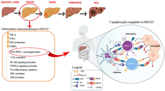 IJMS | Free Full-Text | PD-1/PD-L1 Immuno-Mediated Therapy in NAFLD ...