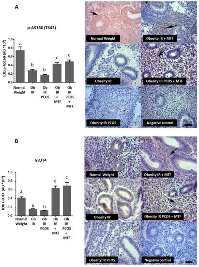 Metformin Treatment Regulates the Expression of Molecules Involved in ...