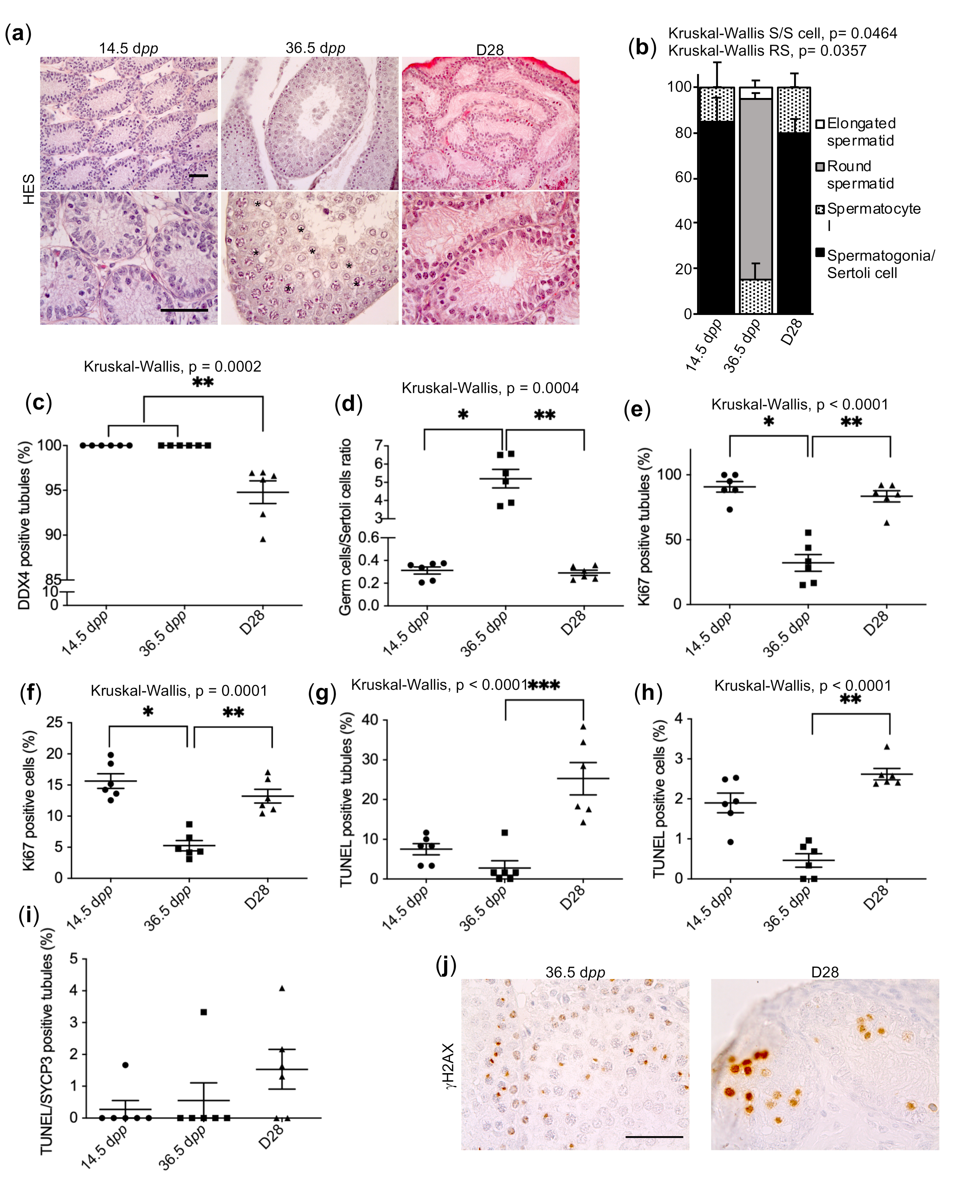 IJMS Free Full-Text Understanding the Underlying Molecular Mechanisms of Meiotic Arrest during In Vitro Spermatogenesis in Rat Prepubertal Testicular Tissue