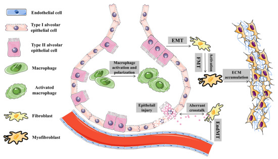 IJMS | Free Full-Text | Role of Circular RNAs in Pulmonary Fibrosis