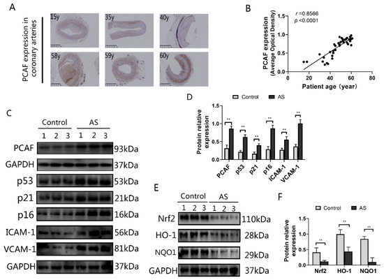 IJMS | Free Full-Text | of P300/CBP-Associated Protects from Vascular Aging via Nrf2 Pathway Activation