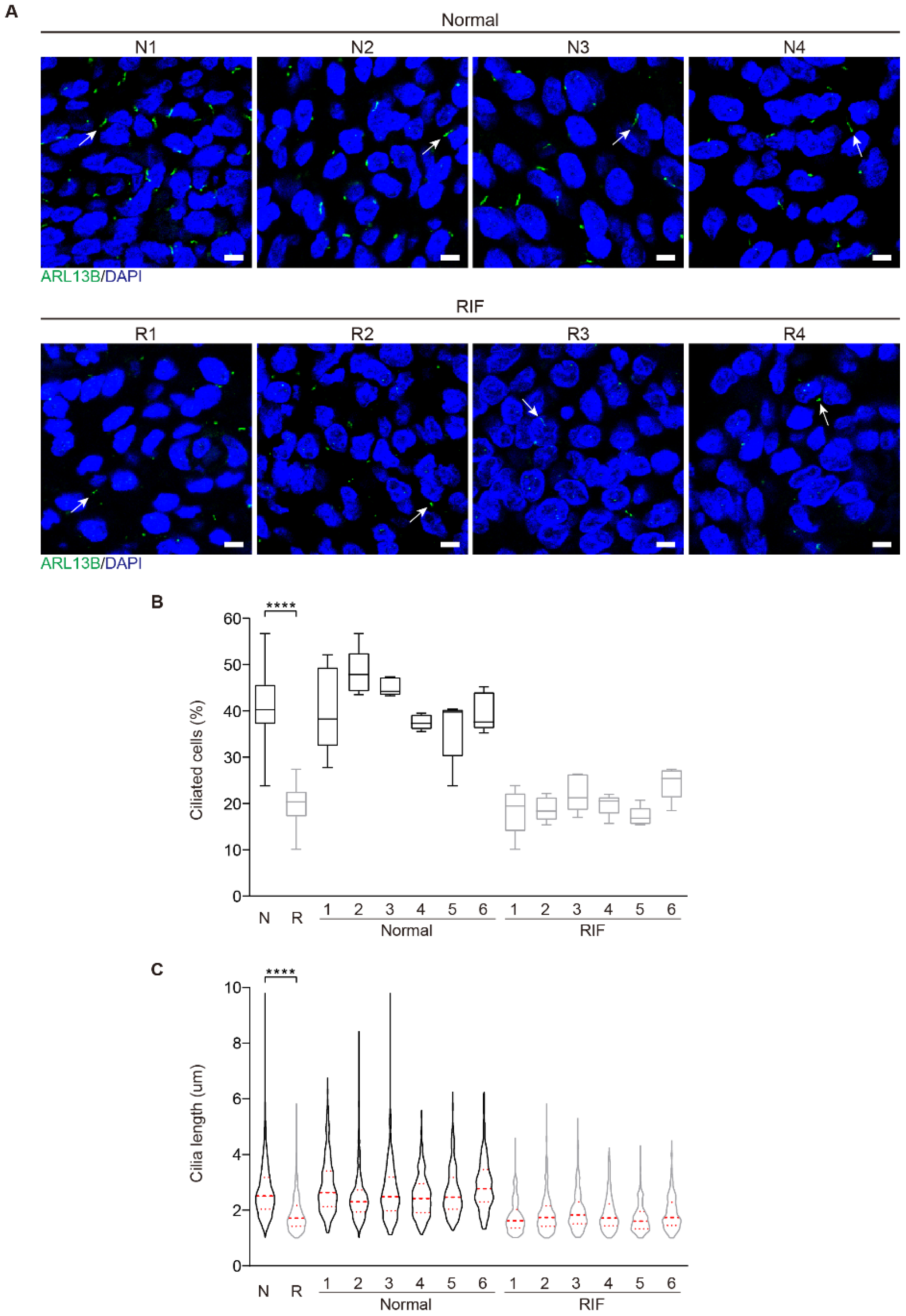 Ijms Free Full Text Primary Cilia Restrain Pi3k Akt Signaling To