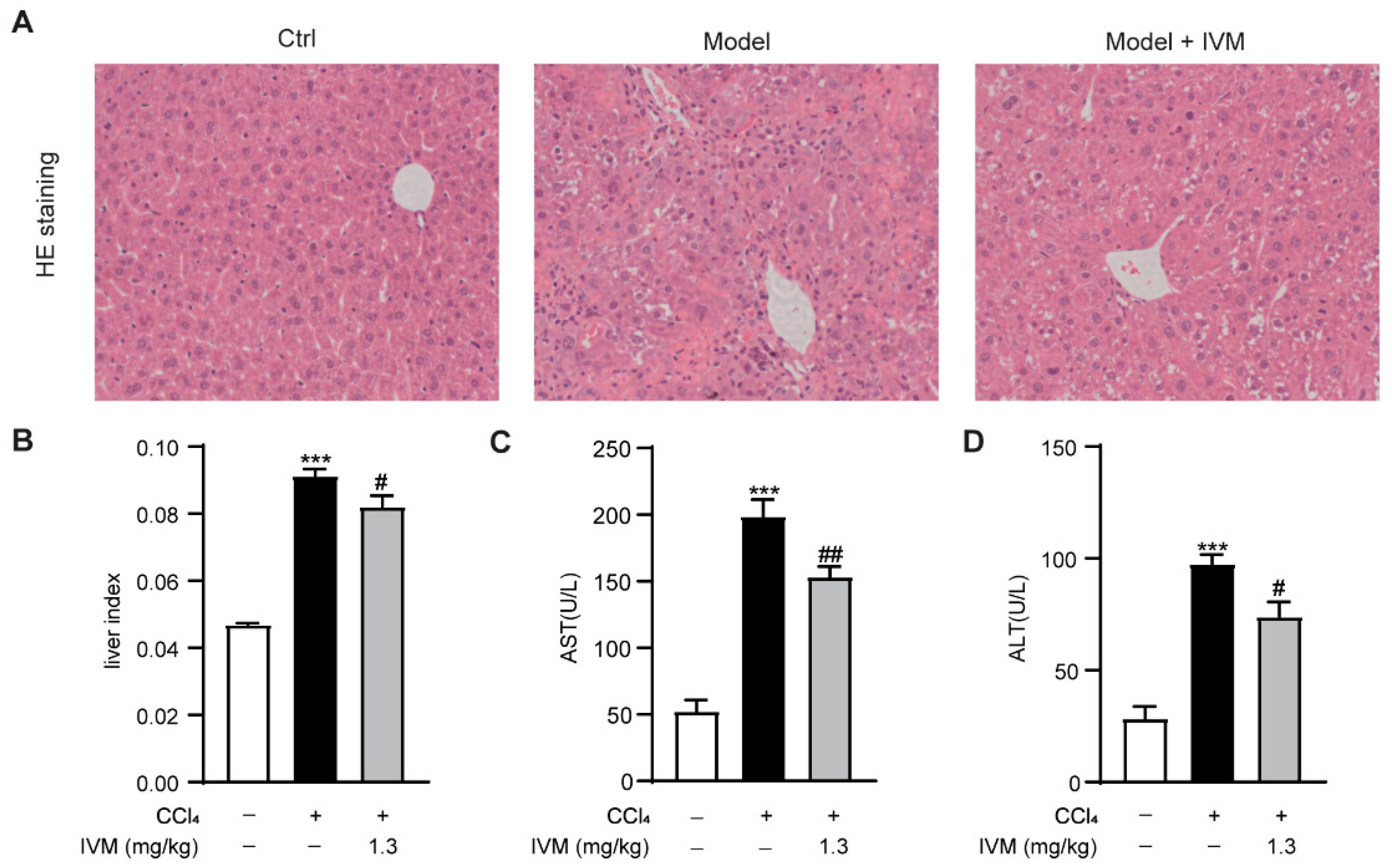 Ijms Free Full Text Ivermectin Attenuates Ccl4 Induced Liver Fibrosis In Mice By Suppressing