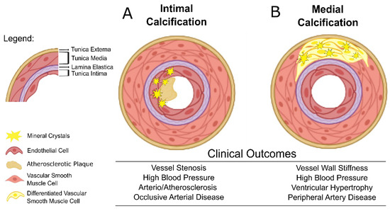 ijms-free-full-text-targeting-a-silent-disease-vascular