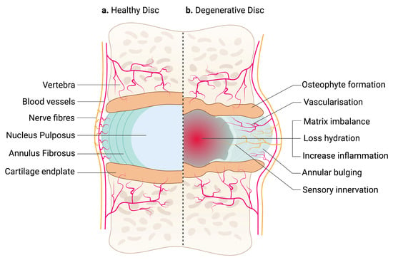 Lumbar Spine Anatomy: Overview, Gross Anatomy, Natural Variants