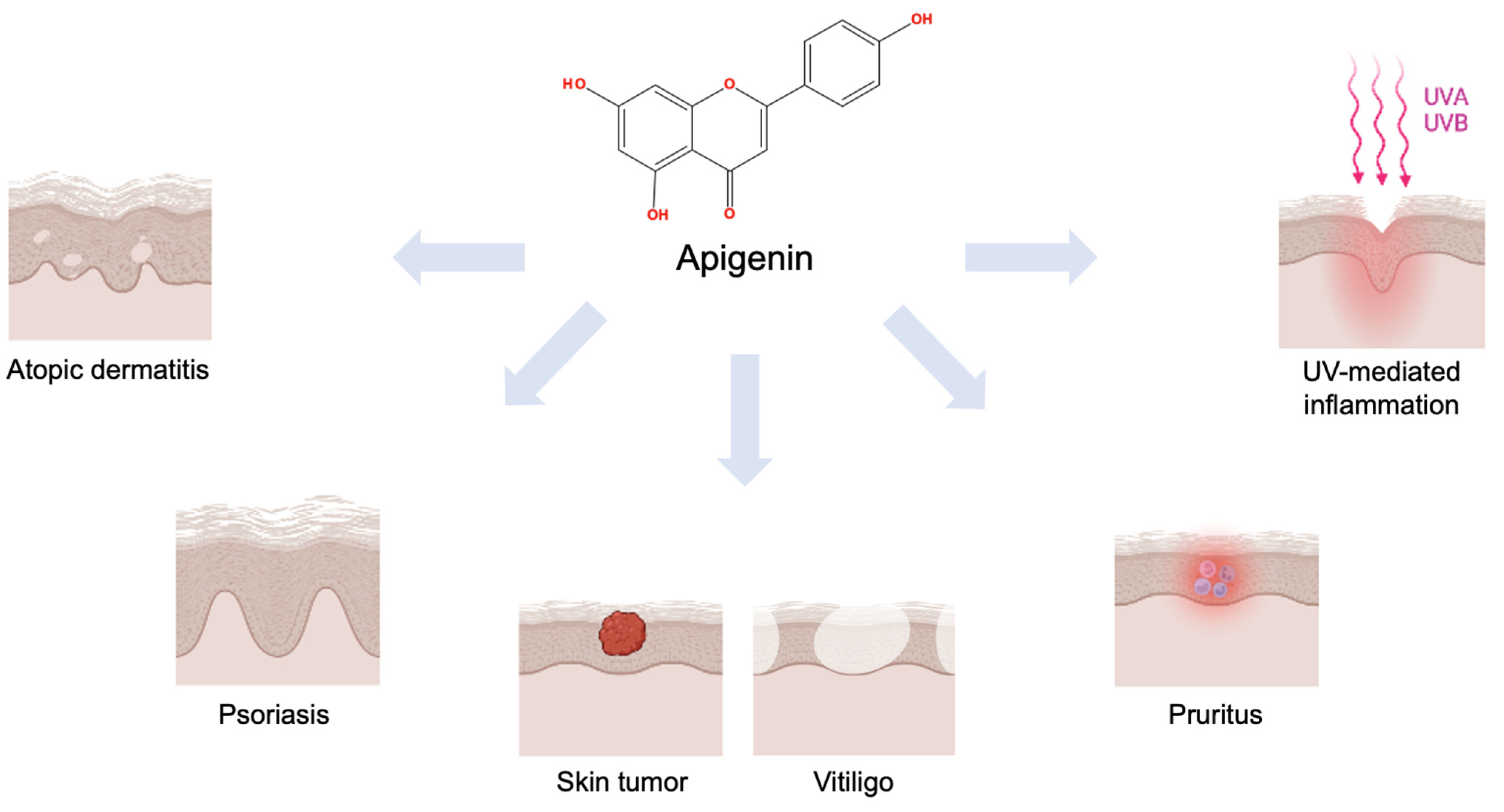 Apigenin: A Therapeutic Agent for Treatment of Skin Inflammatory Diseases and Cancer Apigenin: A Therapeutic Agent for Treatment of Skin Inflammatory Diseases and Cancer