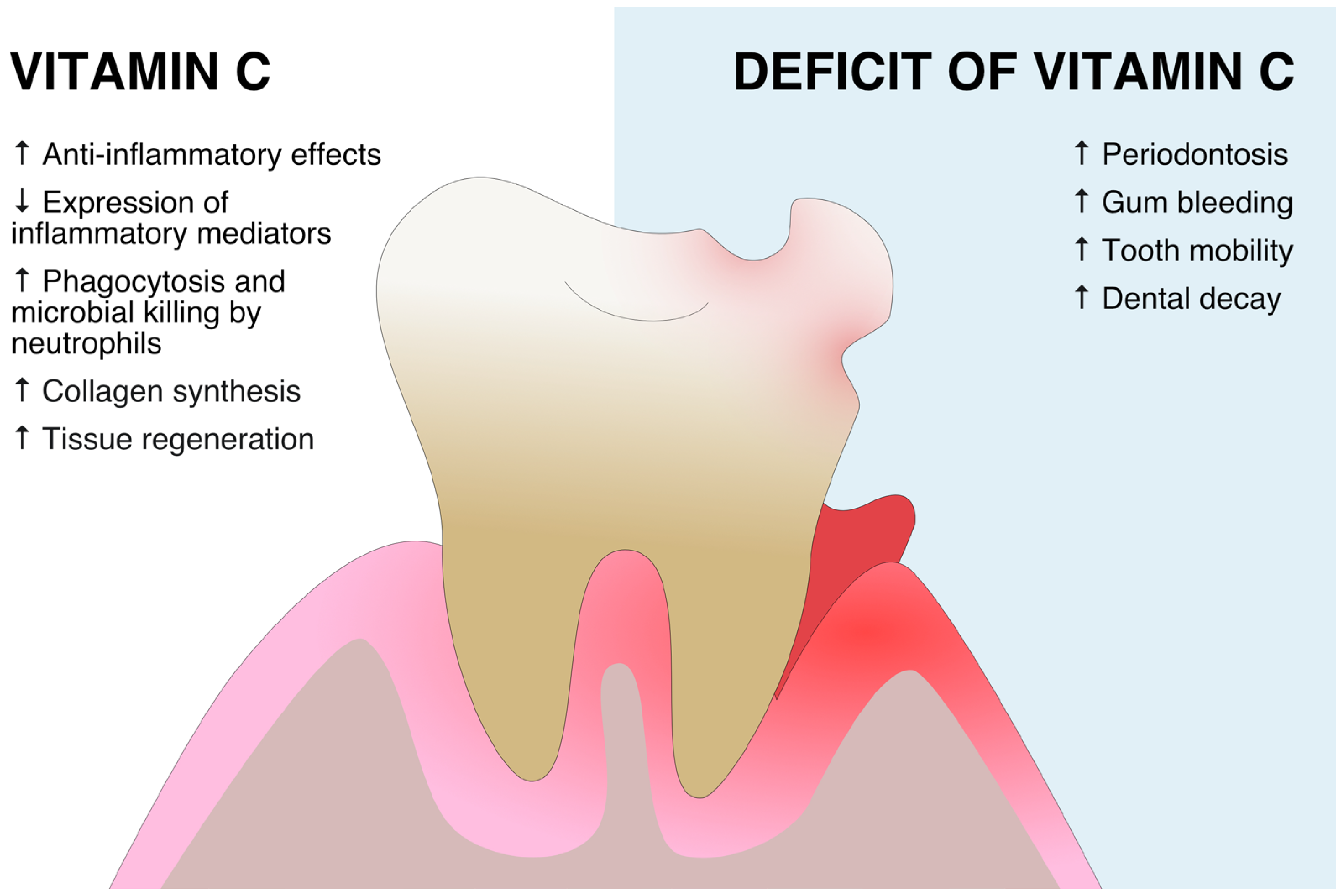 IJMS Free Full Text The Role Of Vitamin C And Vitamin D In The 