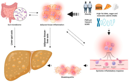 IJMS | Free Full-Text | Fatty Liver Disease, Metabolism and Alcohol ...