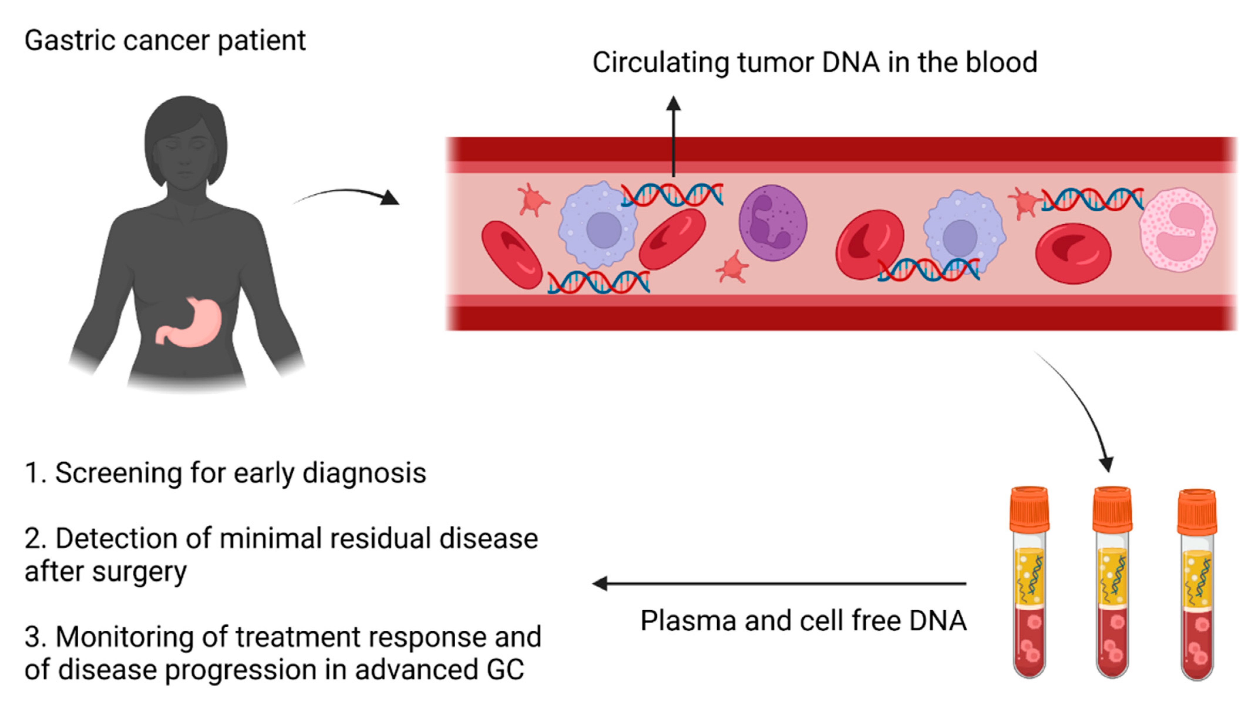 IJMS | Free Full-Text | Circulating Tumor DNA in Gastric 