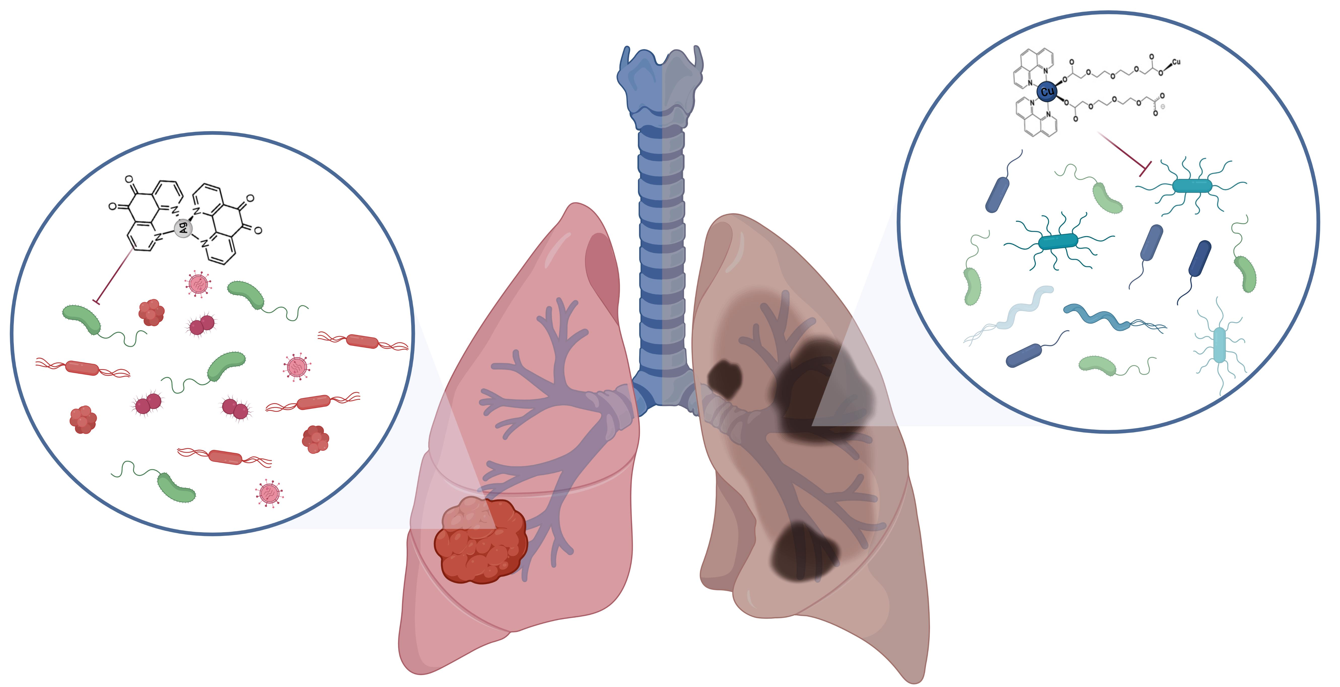 IJMS | Free Full-Text | The Lung Microbiome in COPD and Lung 