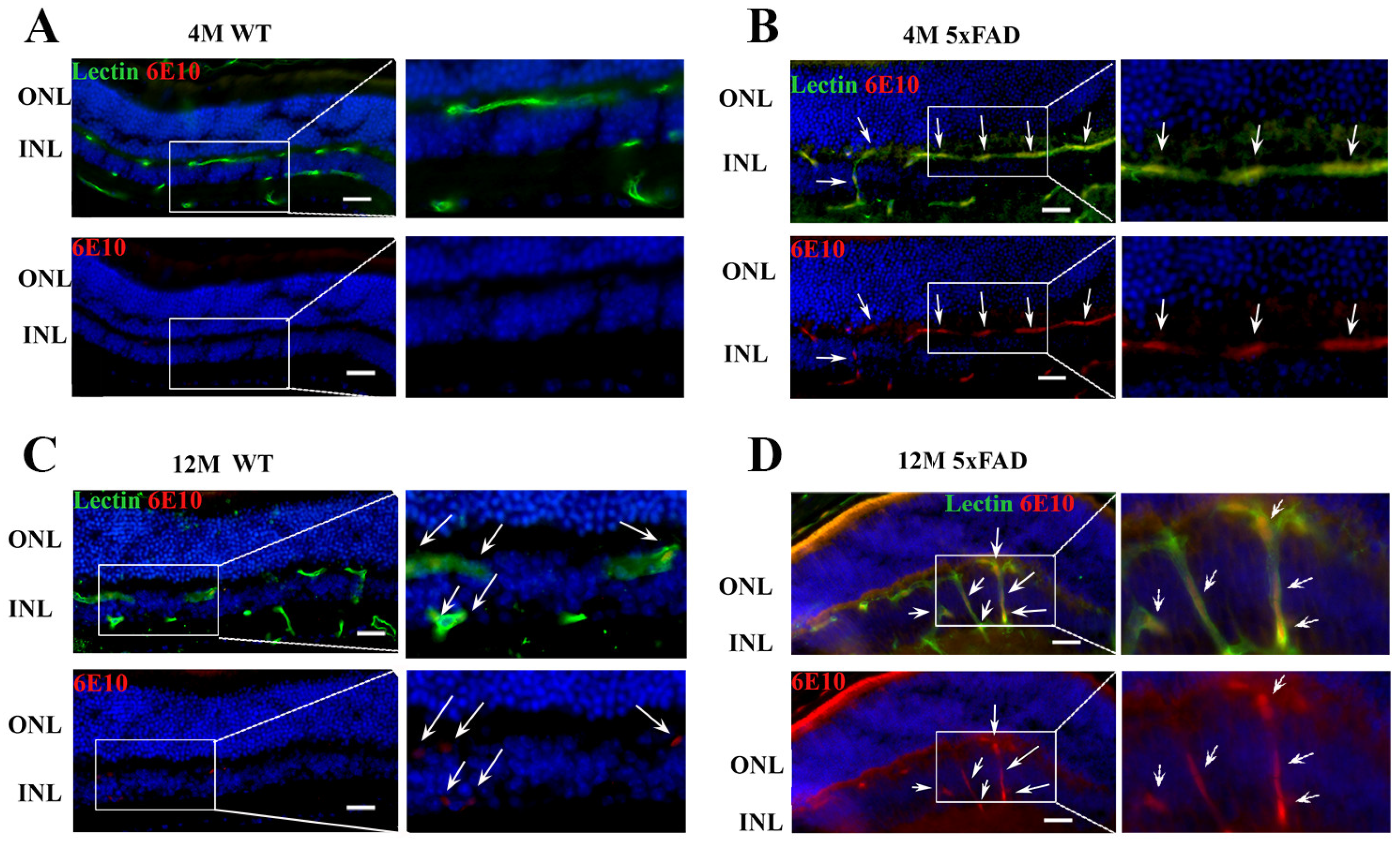 IJMS Free Full-Text The Expression of Major Facilitator Superfamily Domain-Containing Protein2a (Mfsd2a) and Aquaporin 4 Is Altered in the Retinas of a 5xFAD Mouse Model of Alzheimerandrsquo;s Disease photo