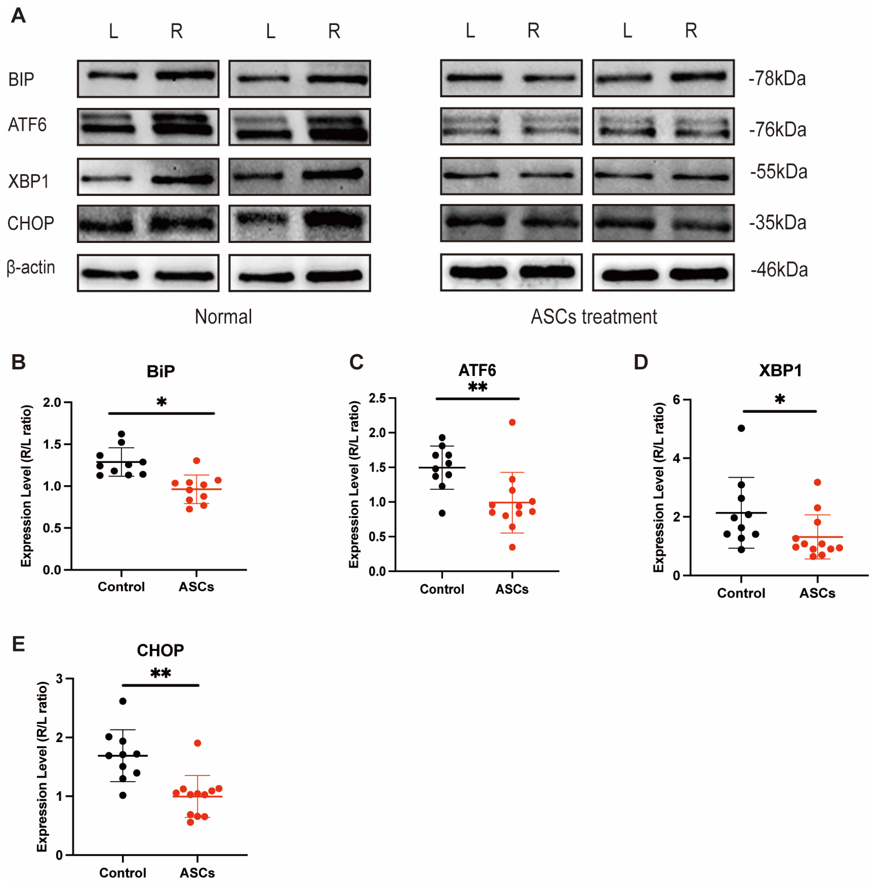 Ijms Free Full Text Upr Signal Activation By Luminal Sensor Domains