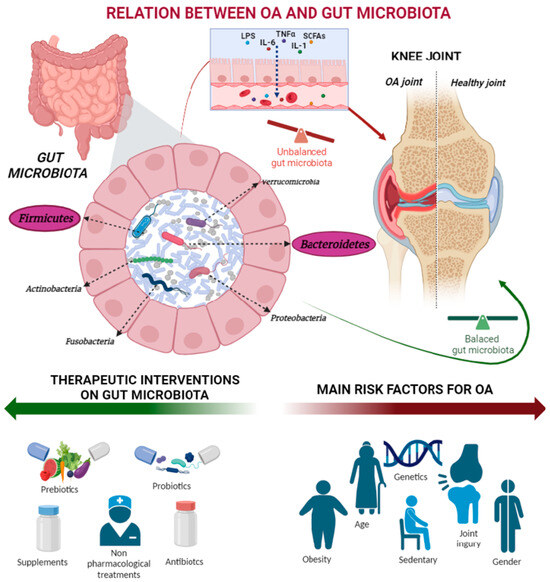 The Complex Interplay between the Gut Microbiome and Osteoarthritis: A ...