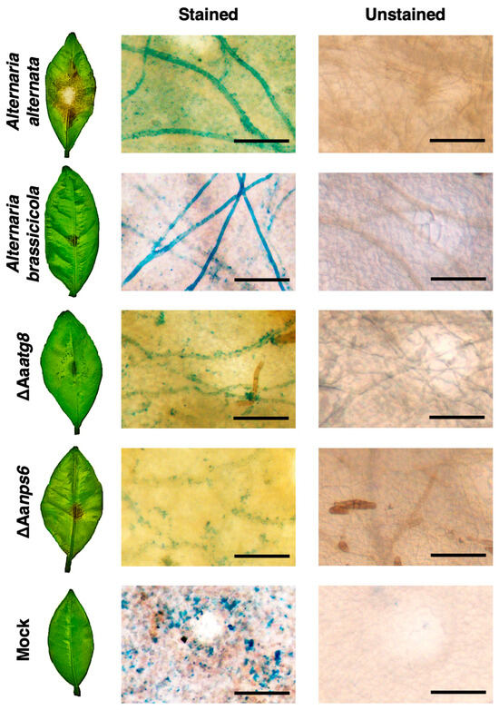 Contribution of Autophagy to Cellular Iron Homeostasis and Stress ...