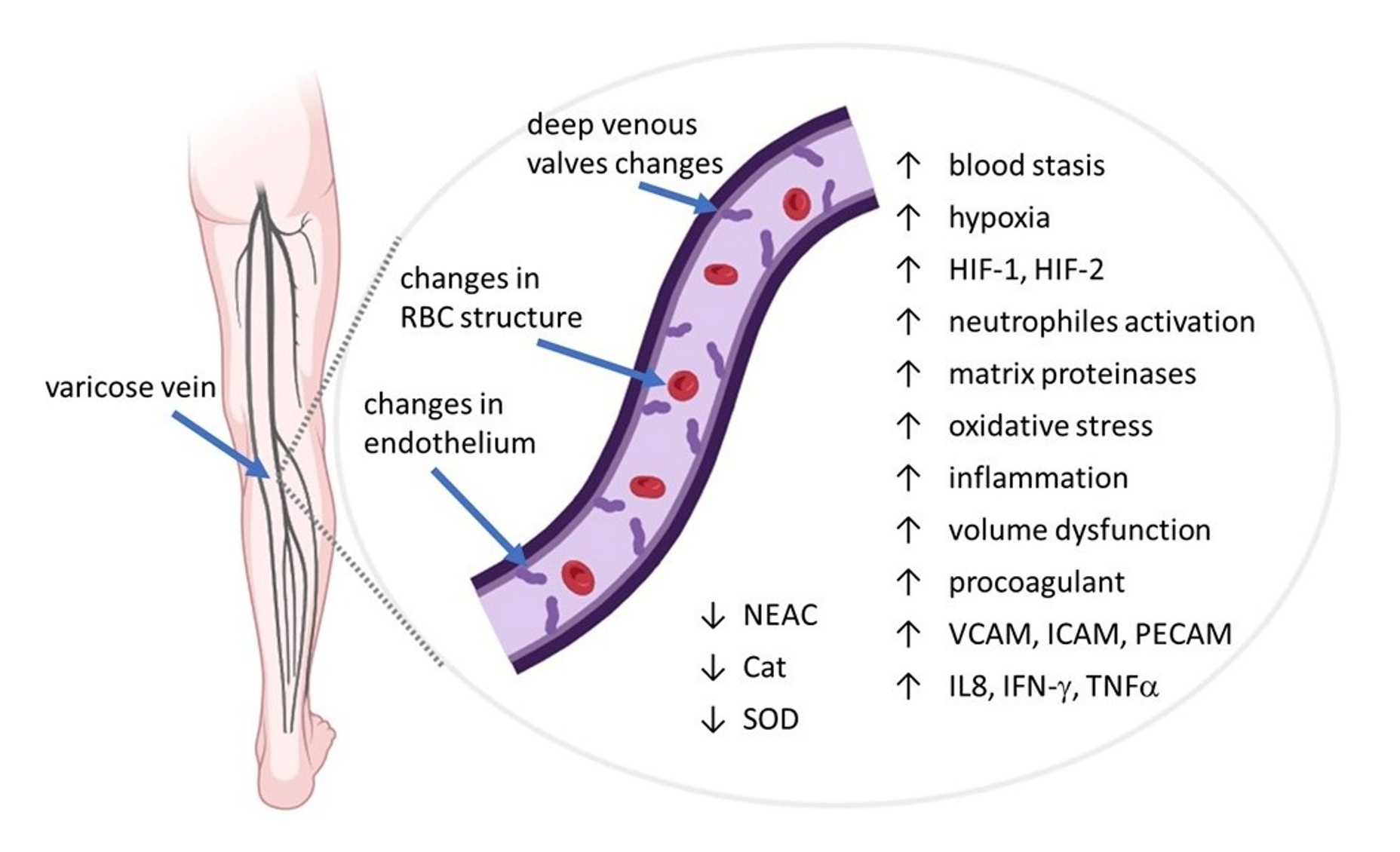 CEAP C2: varicose vein patient, a 40-year-old male, was operated on in