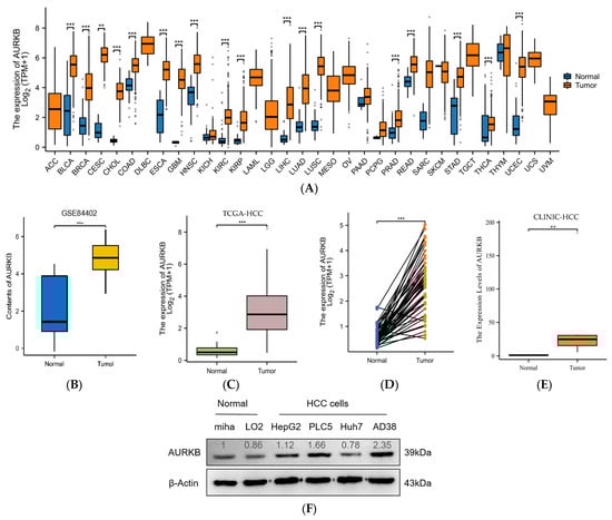Overexpression of Aurora Kinase B Is Correlated ... Biology Diagrams