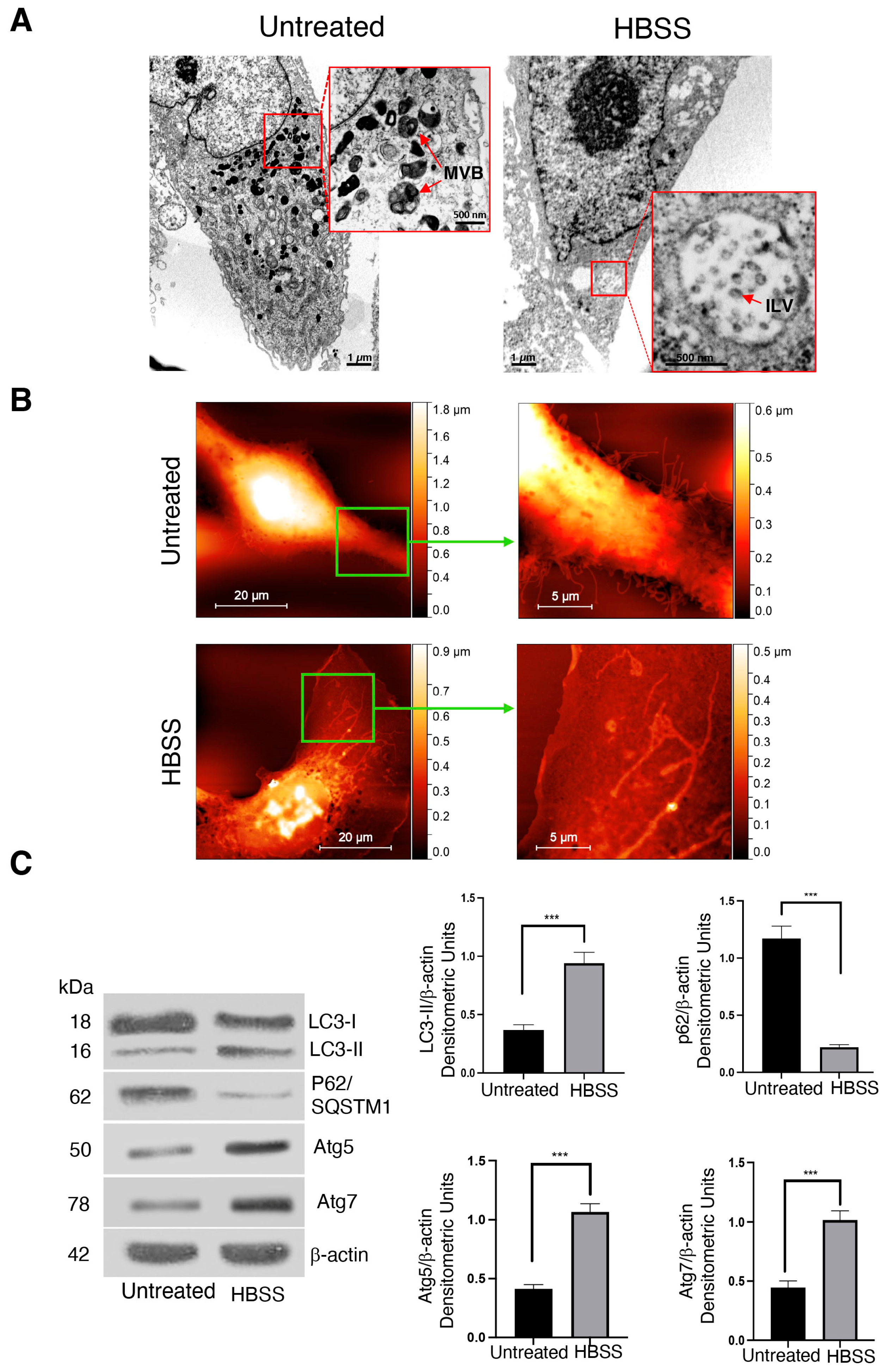 IJMS | Free Full-Text | Autophagy Promotes Enrichment of Raft Components  within Extracellular Vesicles Secreted by Human 2FTGH Cells