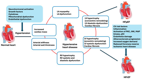 IJMS | Free Full-Text | Hypertension and Heart Failure: From ...