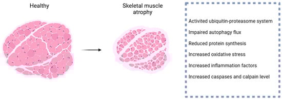 Epigenetics of Skeletal Muscle Atrophy