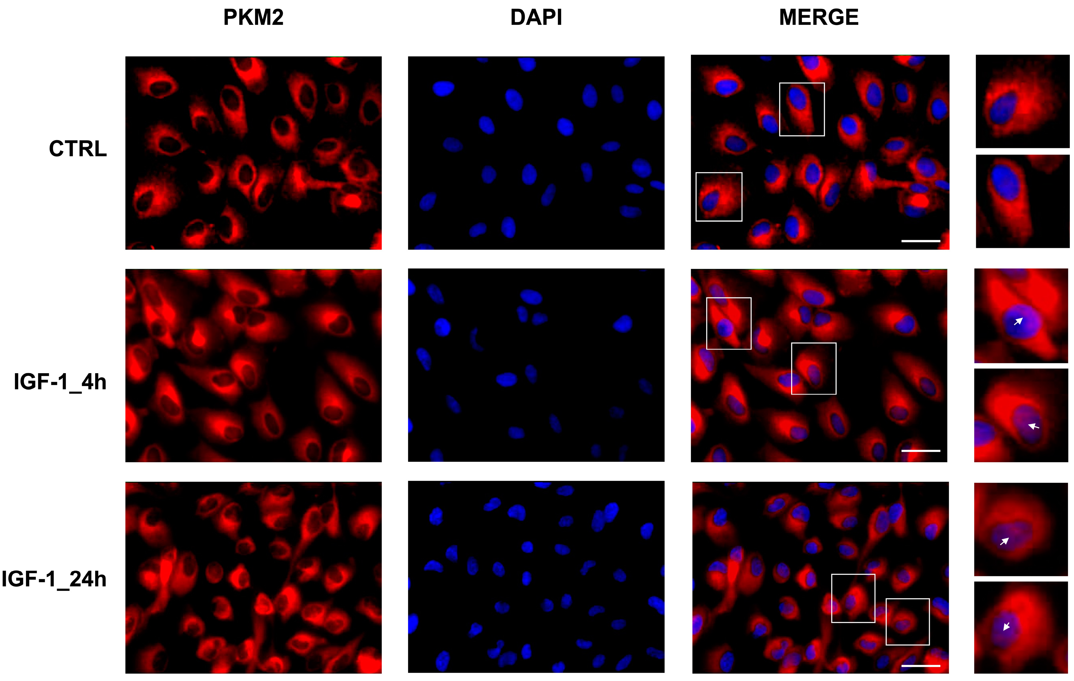 IGF1 Signaling Modulates Oxidative Metabolism and Stress Resistance in