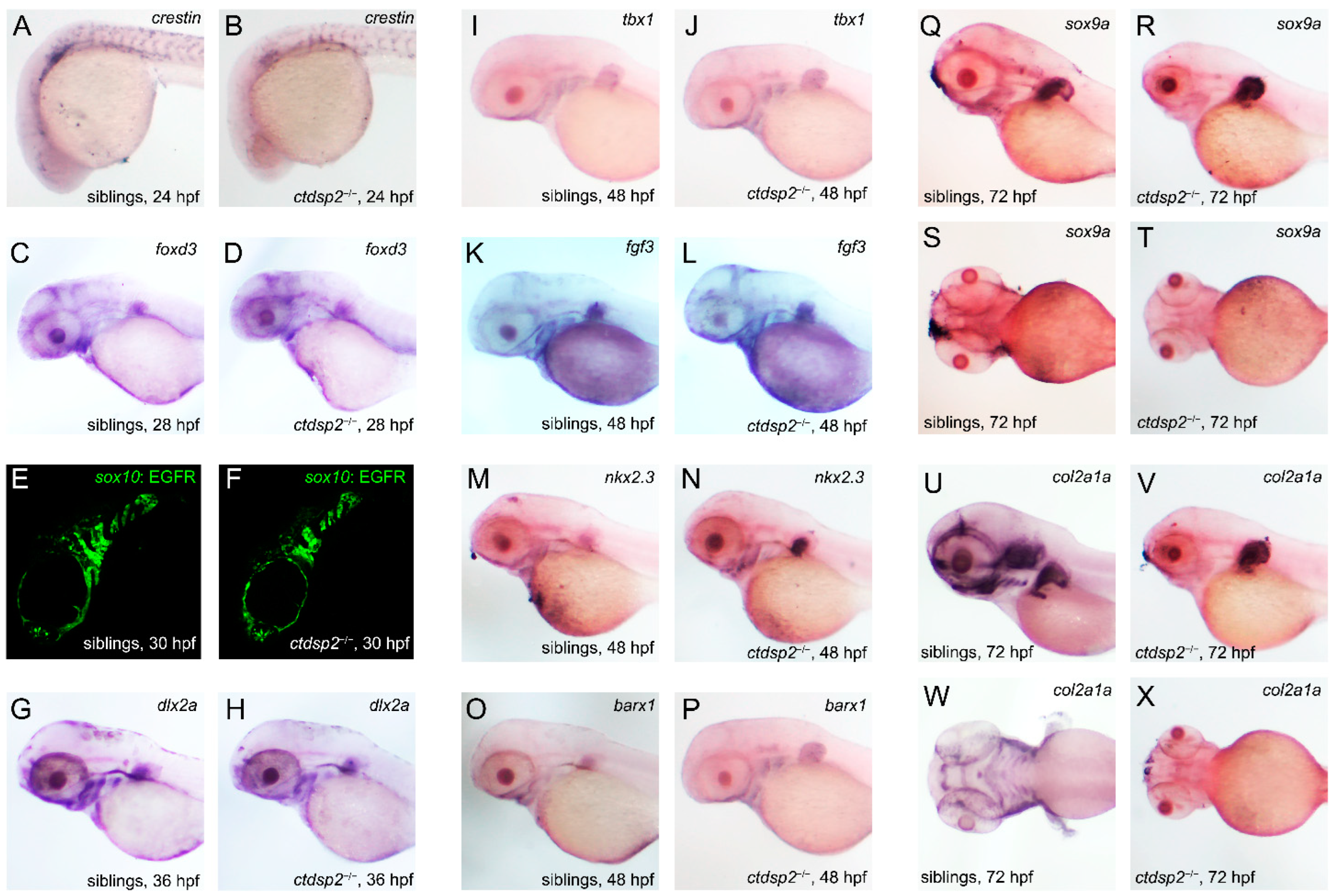 ctdsp2 Knockout Induces Zebrafish Craniofacial Dysplasia via ctdsp2 Knockout Induces Zebrafish Craniofacial Dysplasia via