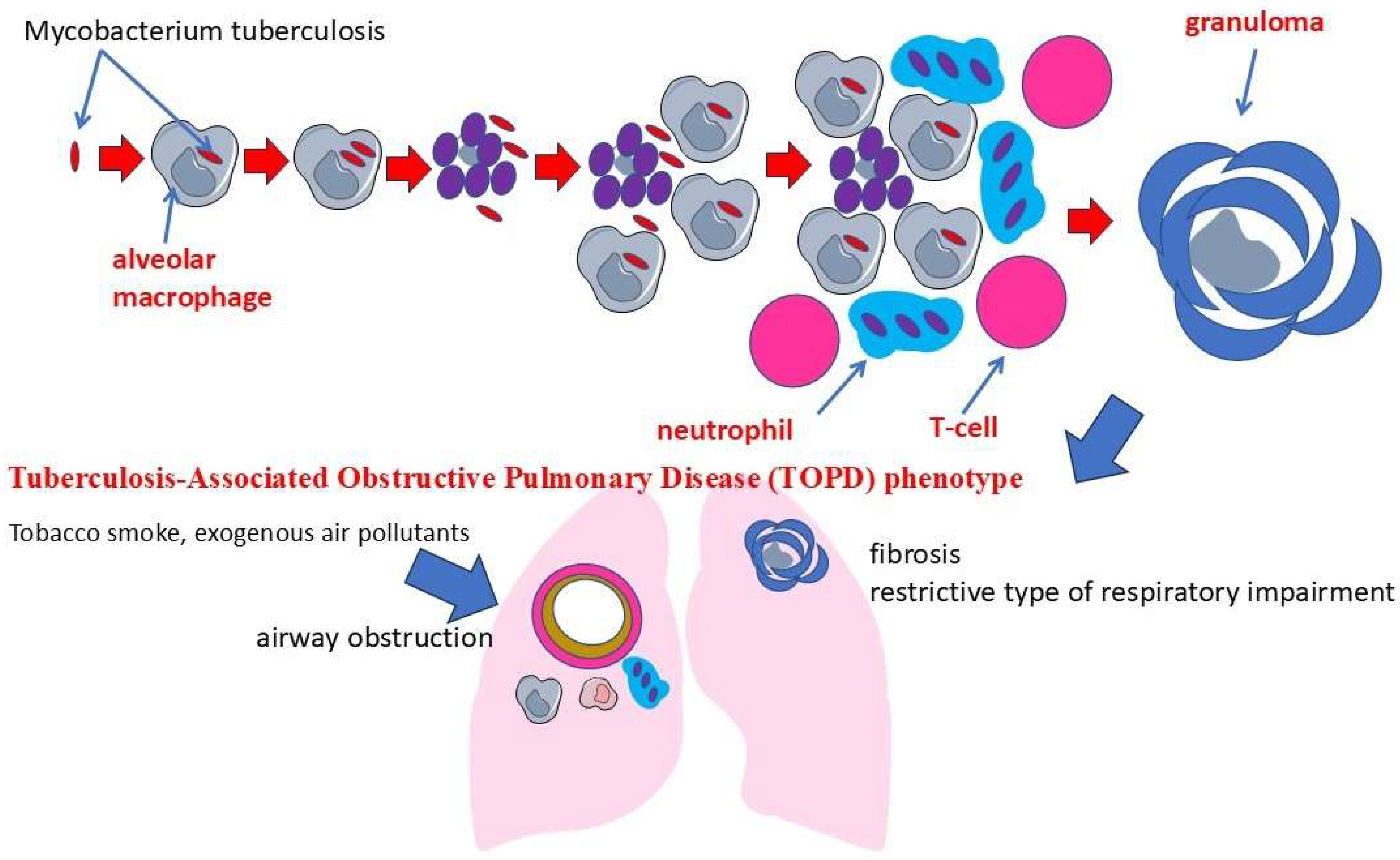 The Role of Inflammation in the Pathogenesis of Comorbidity of Chronic ...