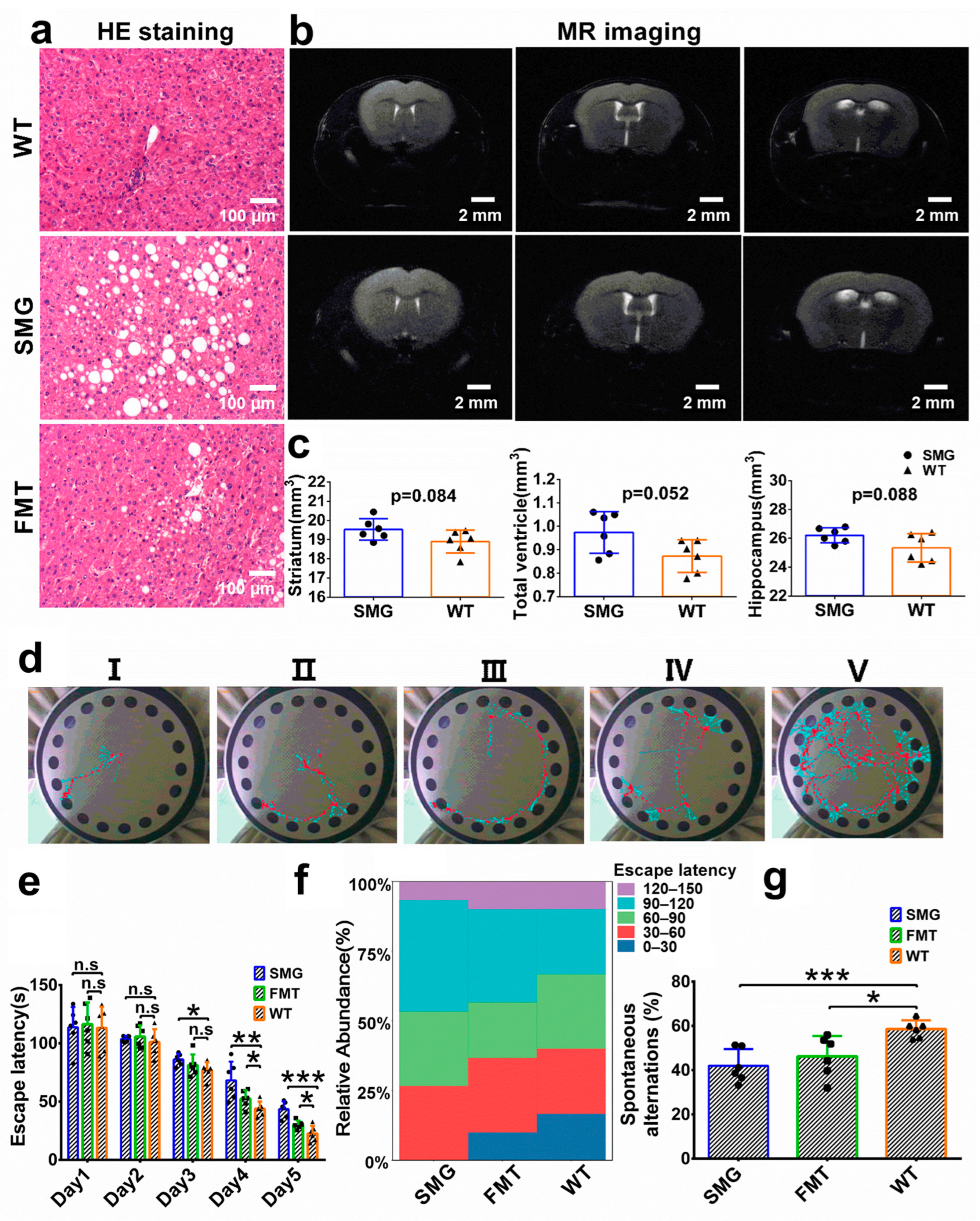 Molecular Mechanism of Microgravity-Induced Intestinal Flora Molecular Mechanism of Microgravity-Induced Intestinal Flora