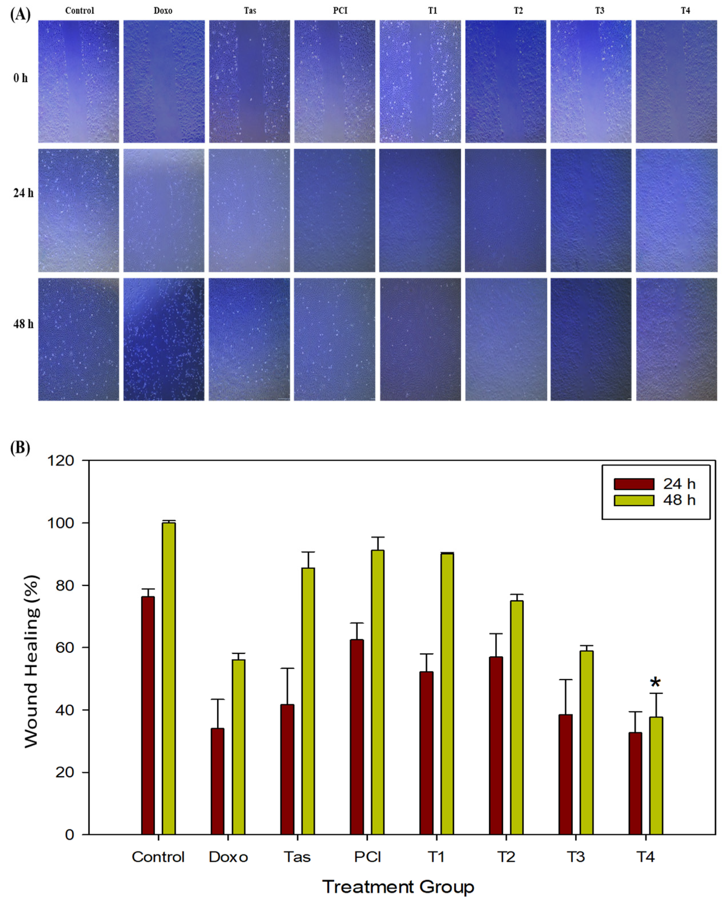 ハート Ophiolites in the Central Asian Orogenic Belt record