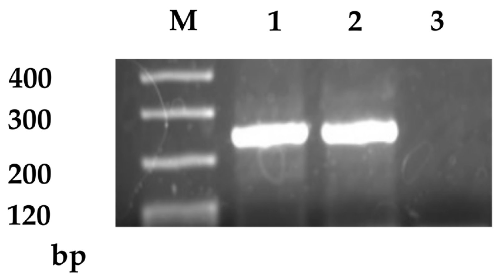 CD133 Expression in Circulating Tumor Cells as a Prognostic
