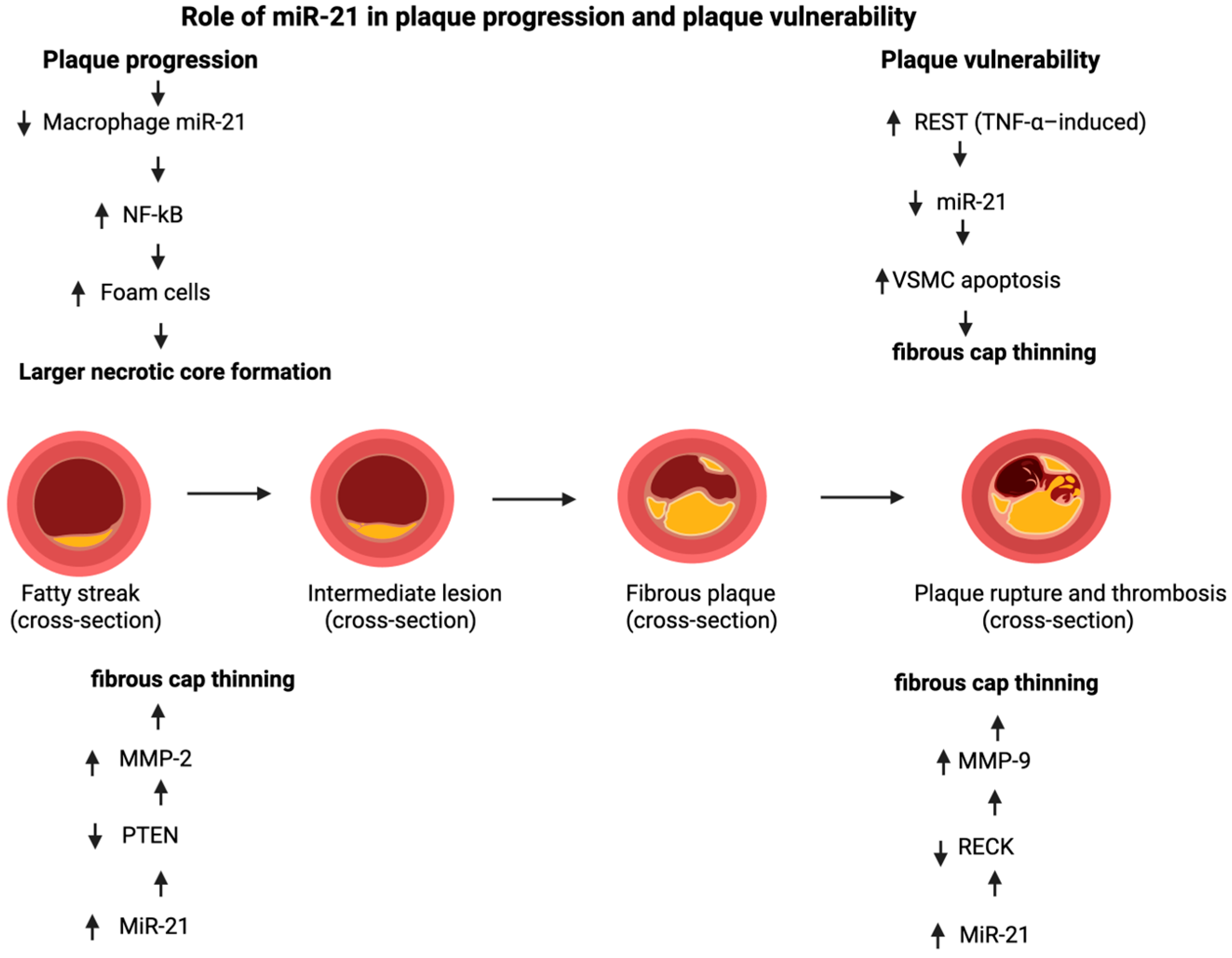 Diagnostic, Prognostic and Therapeutic Utility of MicroRNA-21 in ...