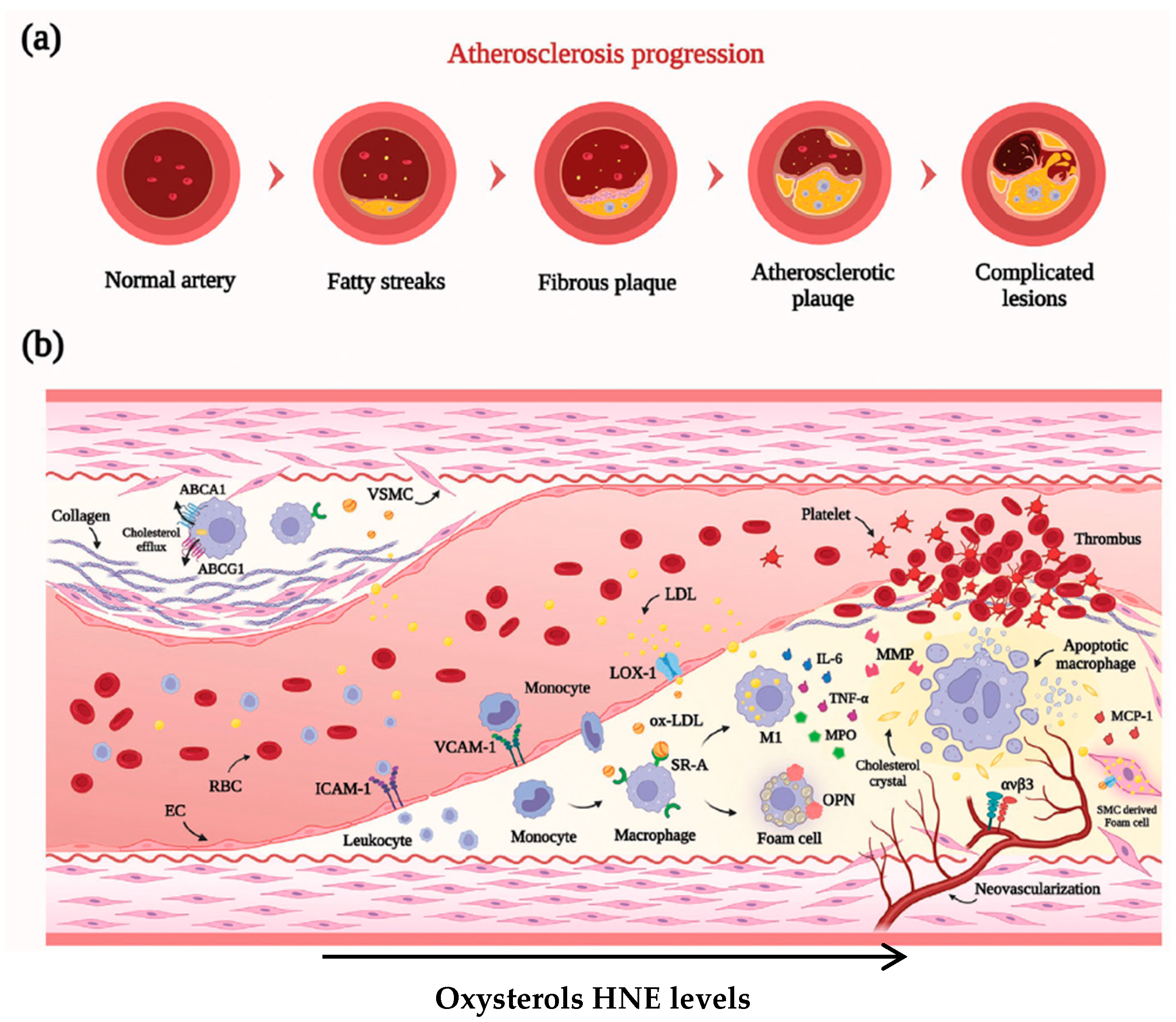 Oxidative Stress and Its Role in Vascular Damage and Atherosclerosis
