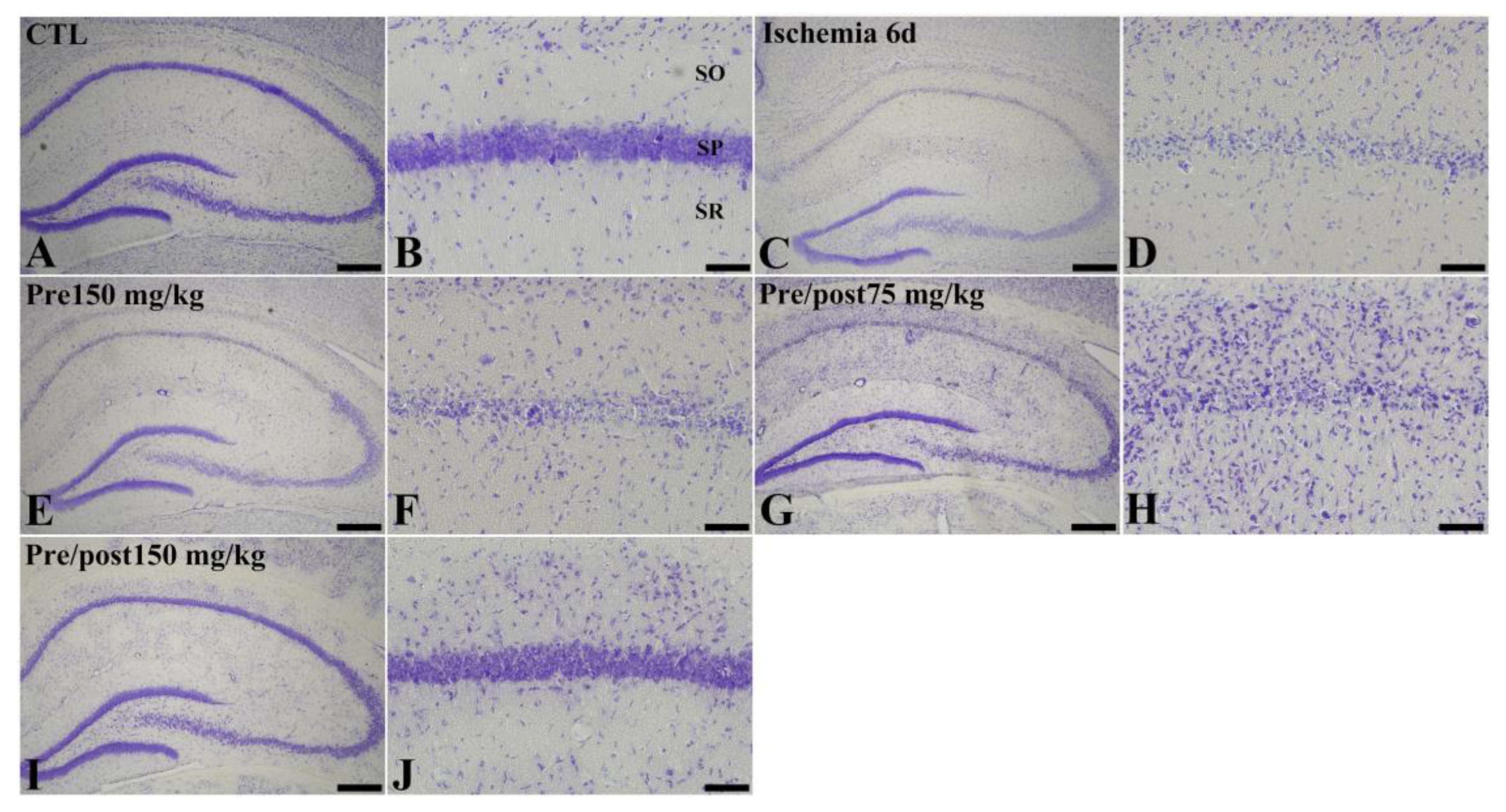 Effects of Pre- and Post-Supplementation of Taurine in the Hippocampus ...