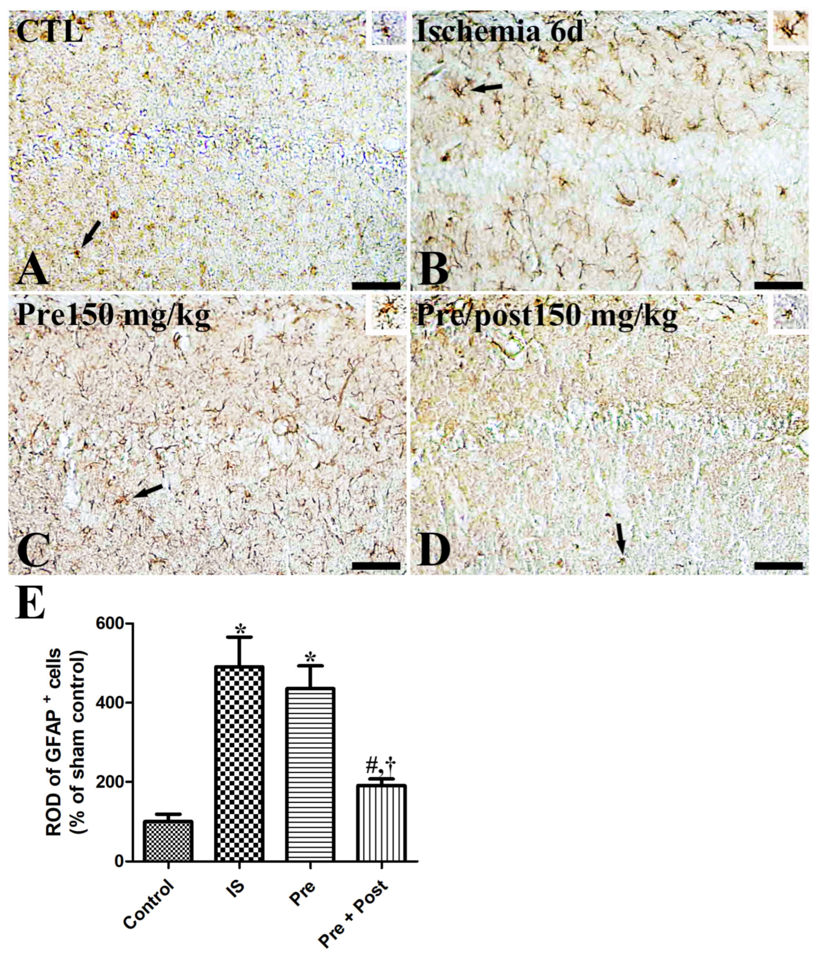 Effects of Pre- and Post-Supplementation of Taurine in the Hippocampus ...