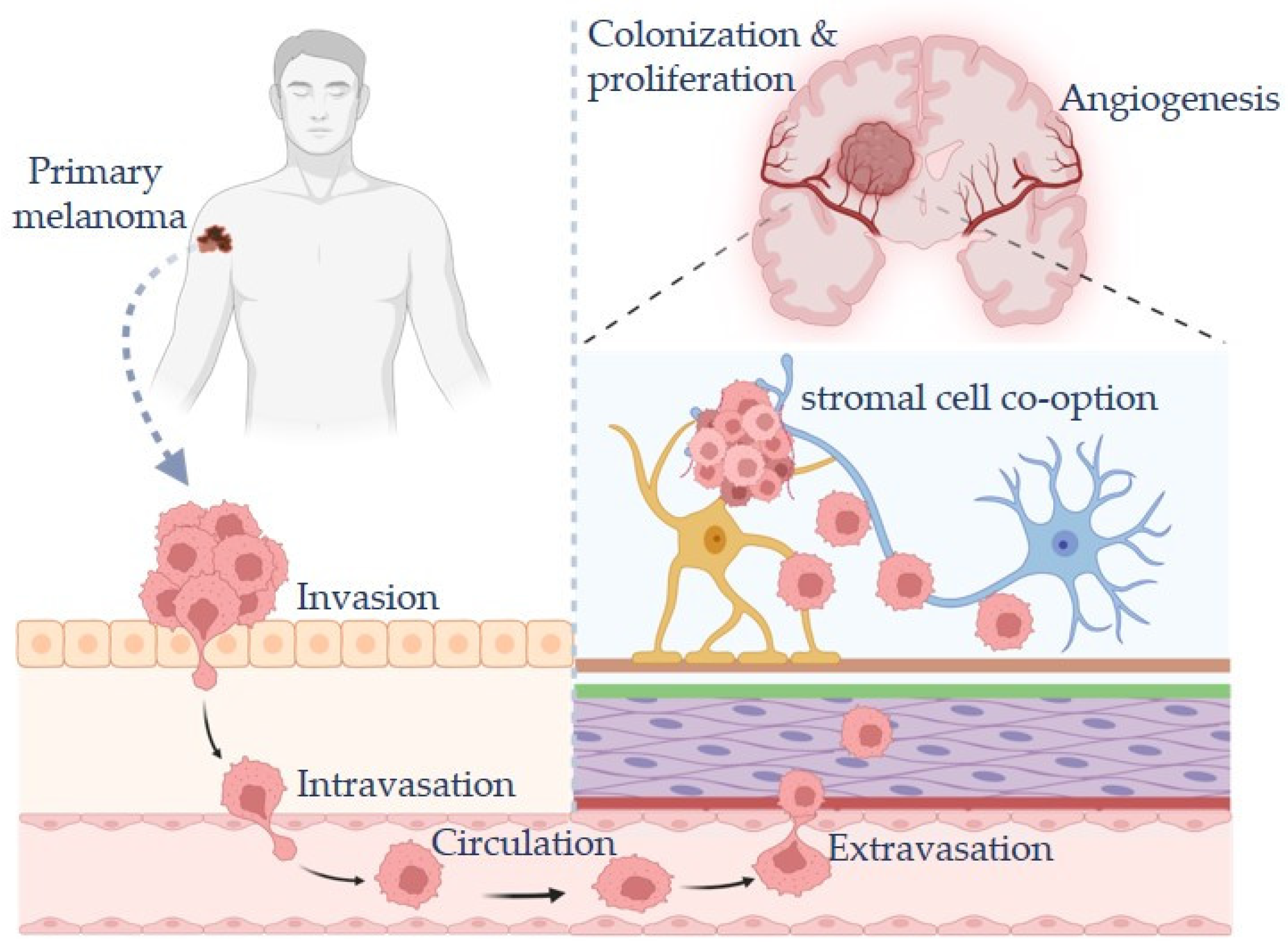Unraveling the Enigma of Melanoma Brain Metastasis: New Molecular ...