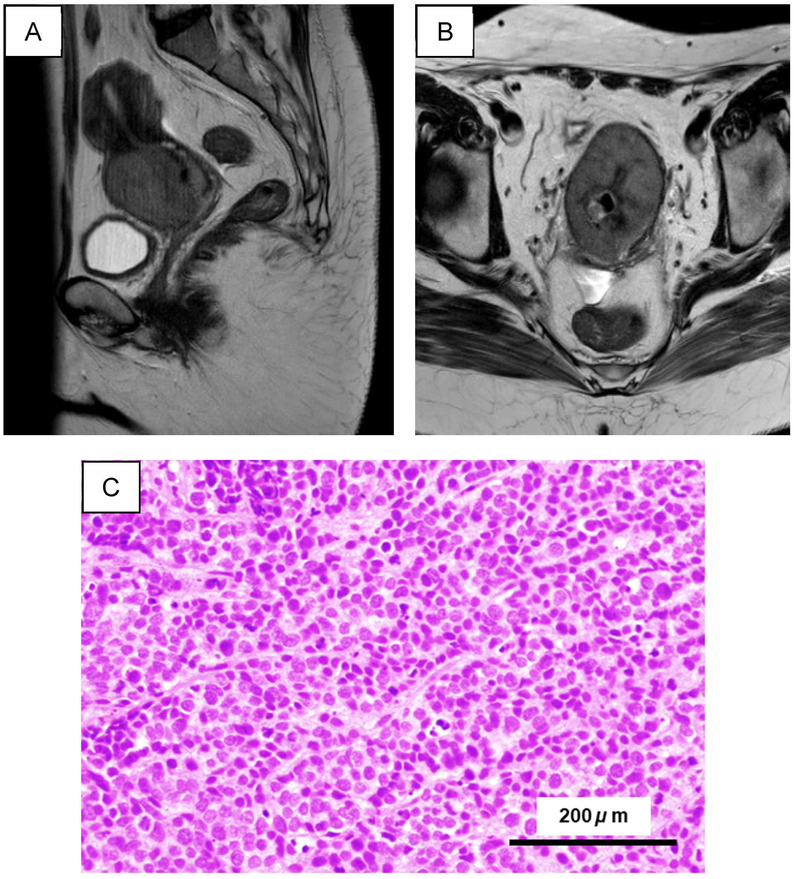 Integrated Molecular and Functional Characterization of Cervical Small ...