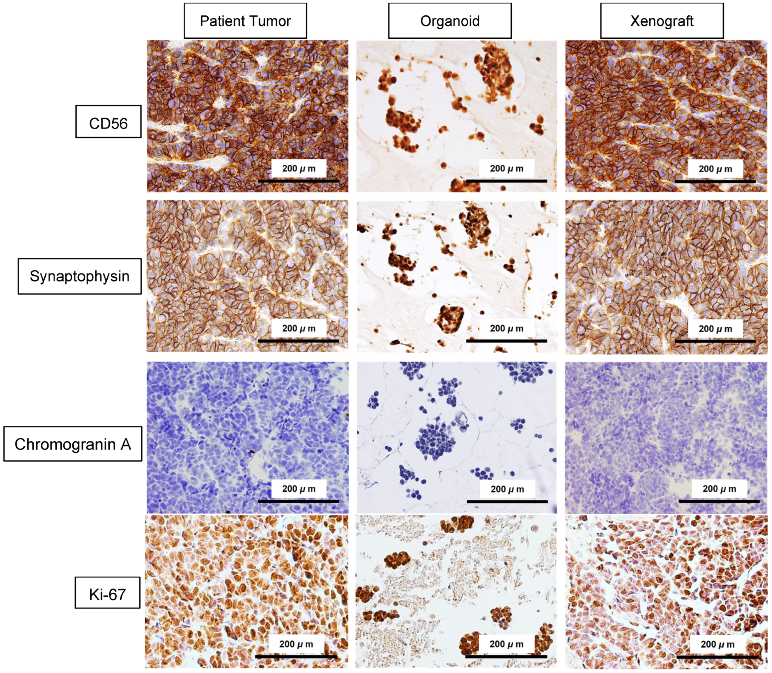 Integrated Molecular and Functional Characterization of Cervical Small ...