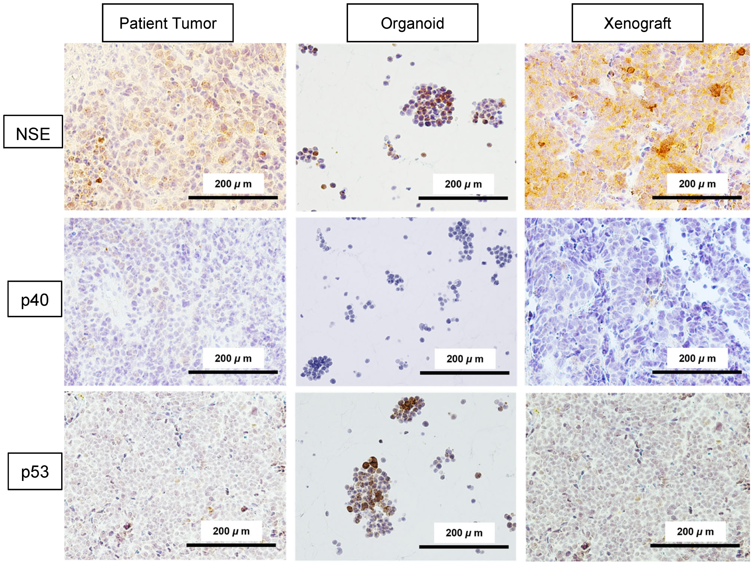Integrated Molecular and Functional Characterization of Cervical Small ...