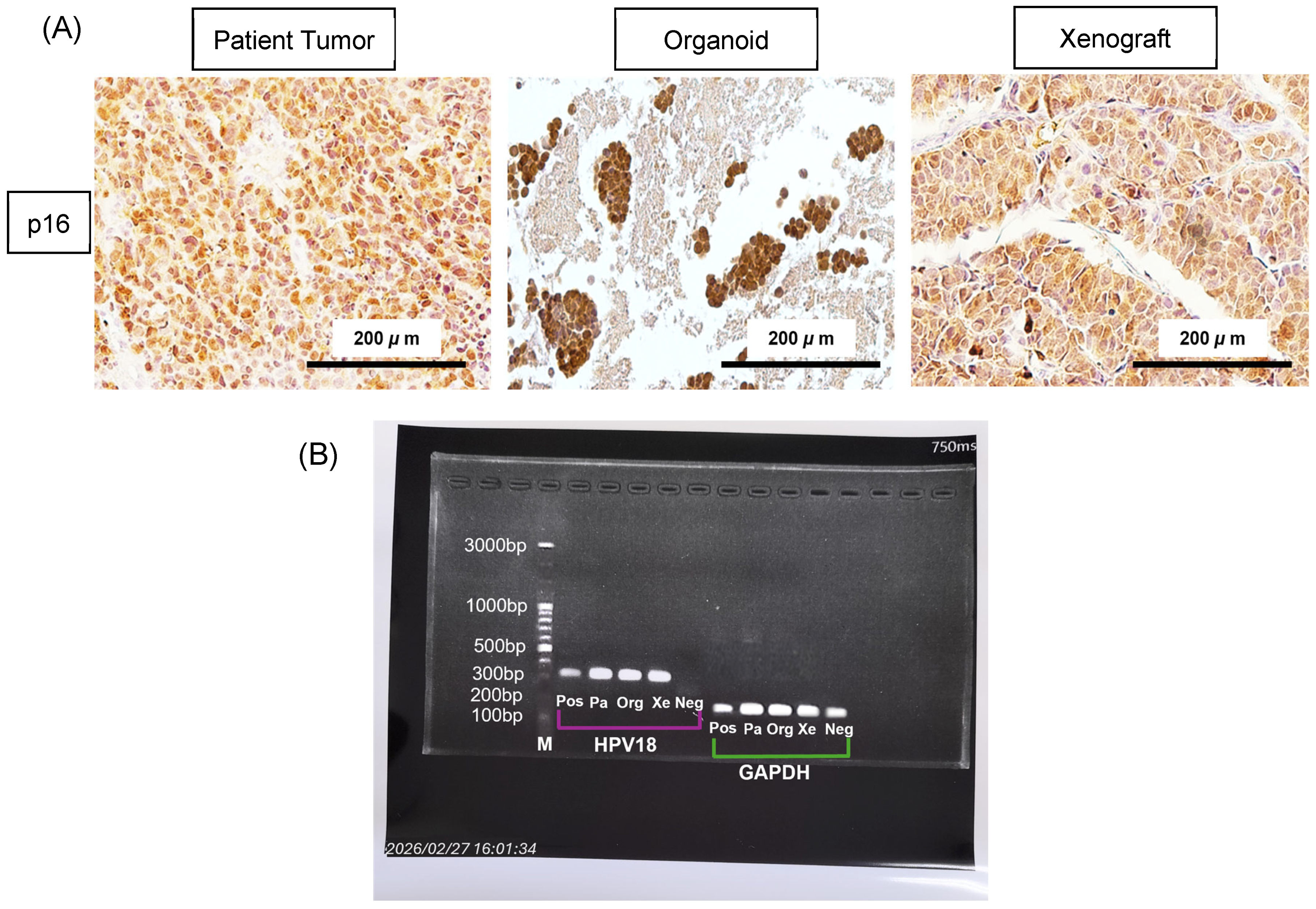 Integrated Molecular and Functional Characterization of Cervical Small ...