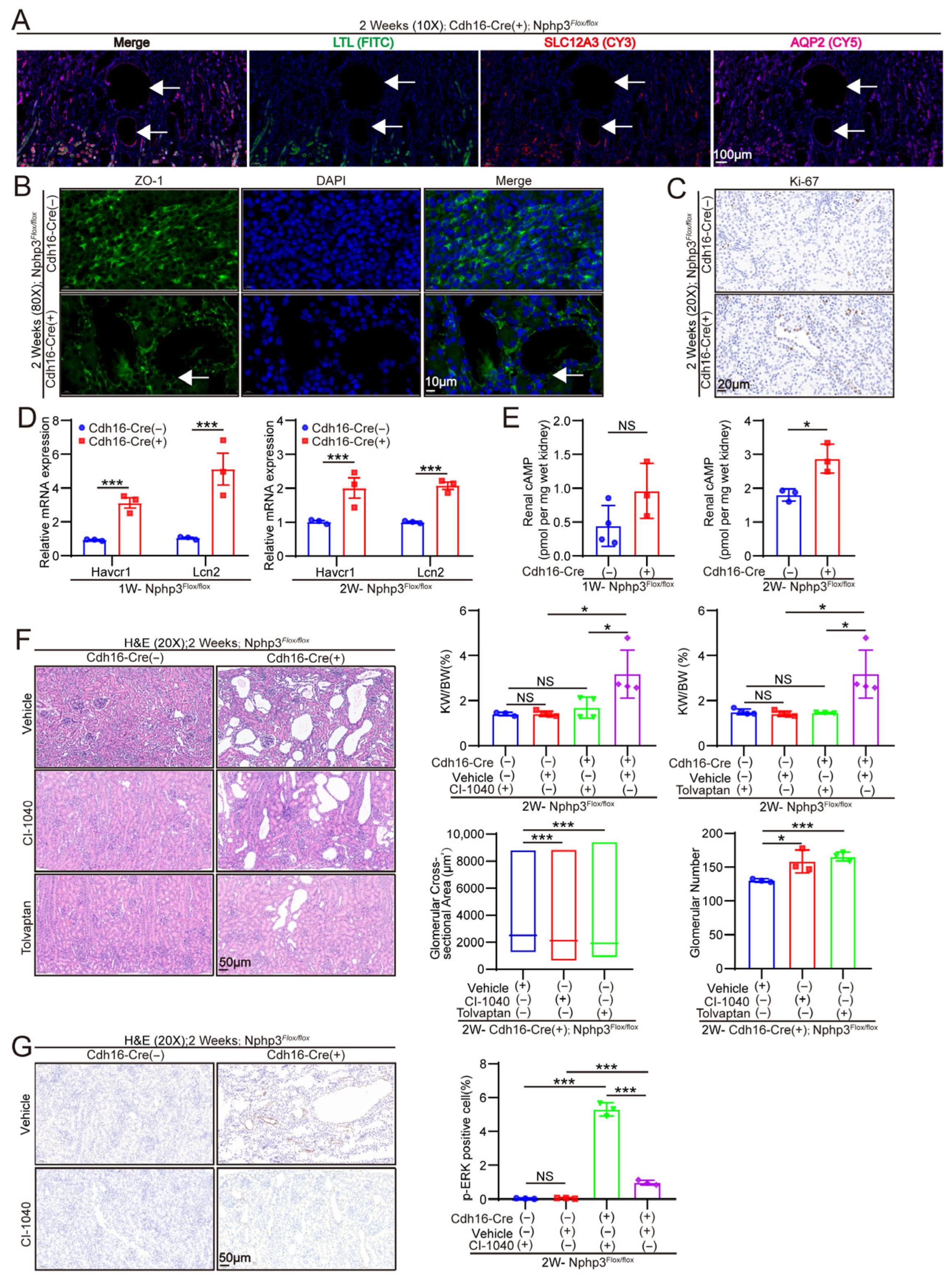 Renal Tubule-Specific Deletion of Nephrocystin 3 (Nphp3) Causes ...