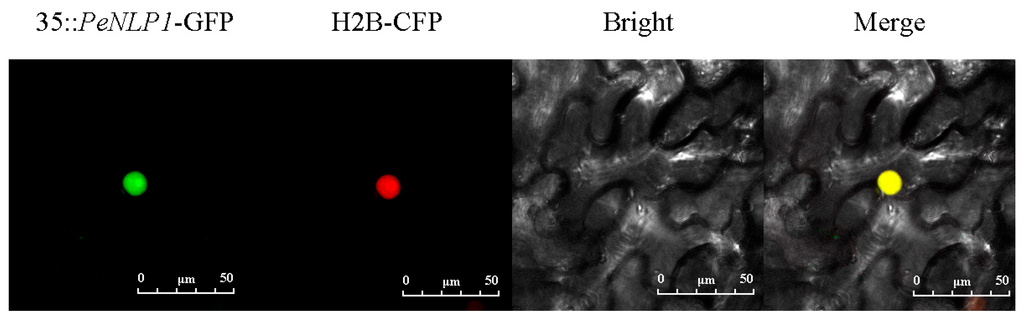 Identification of the NLP Gene Family in Populus euphratica and Its ...