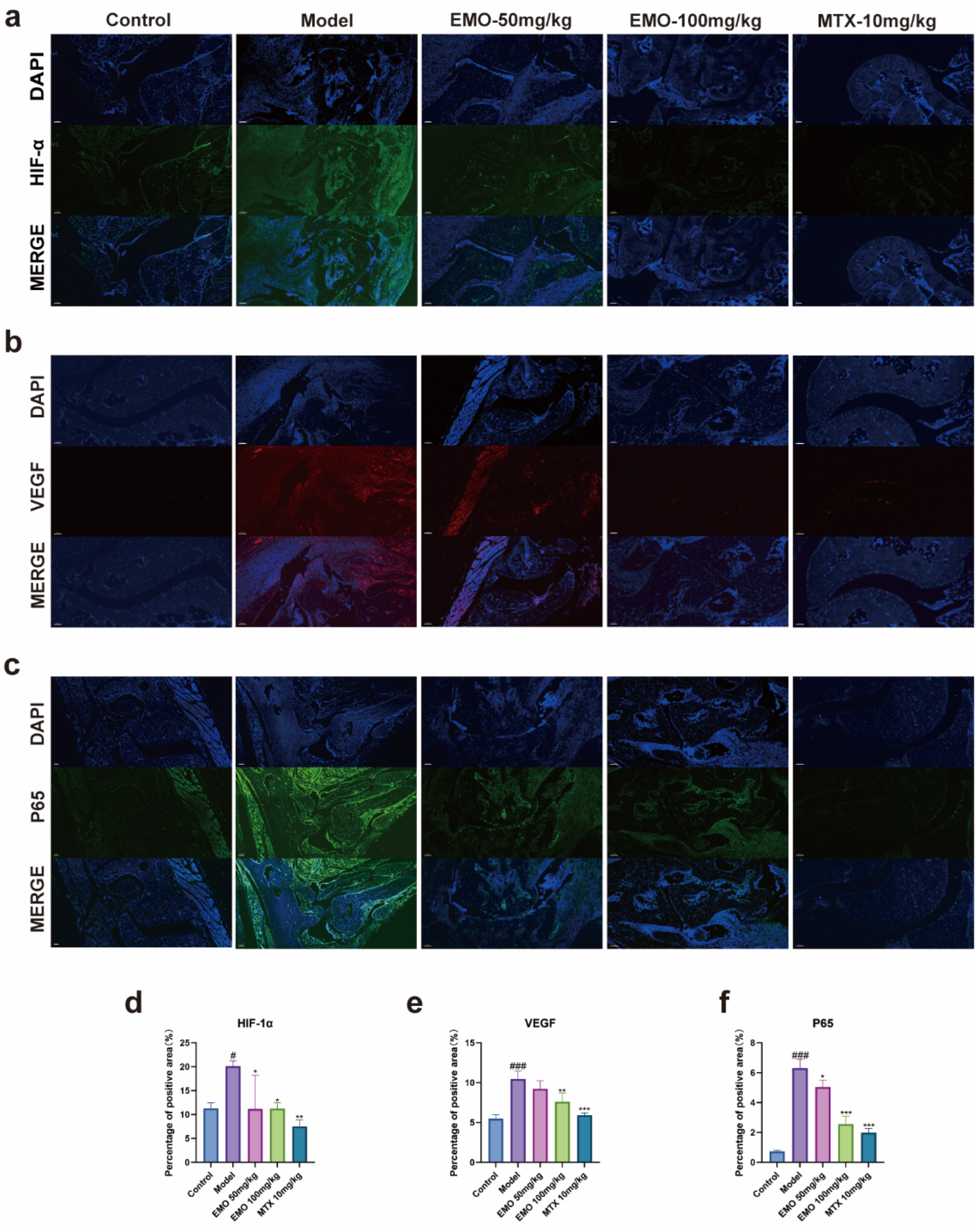 Emodin Attenuates Rheumatoid Arthritis by Modulating the NF-κB/HIF-1α ...