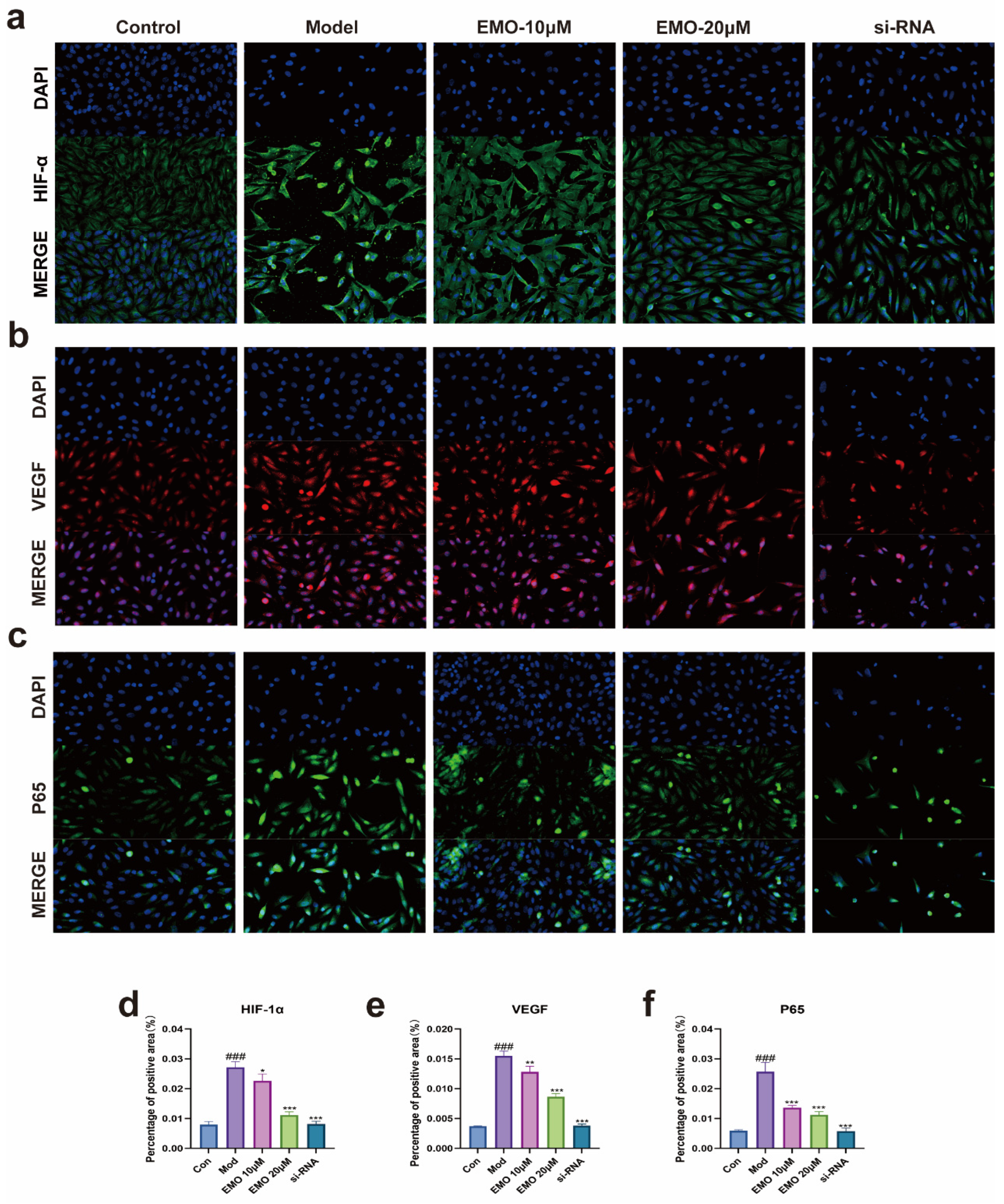 Emodin Attenuates Rheumatoid Arthritis by Modulating the NF-κB/HIF-1α ...