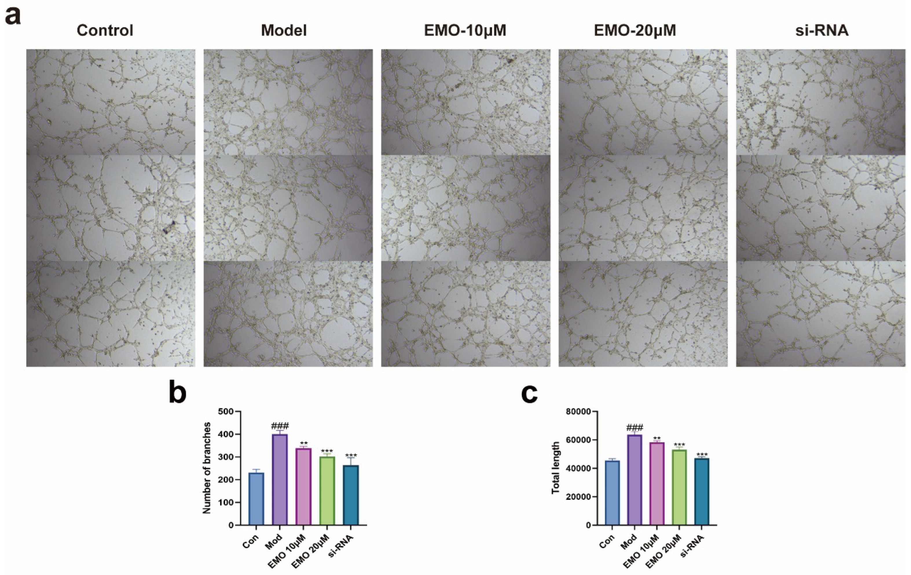 Emodin Attenuates Rheumatoid Arthritis by Modulating the NF-κB/HIF-1α ...