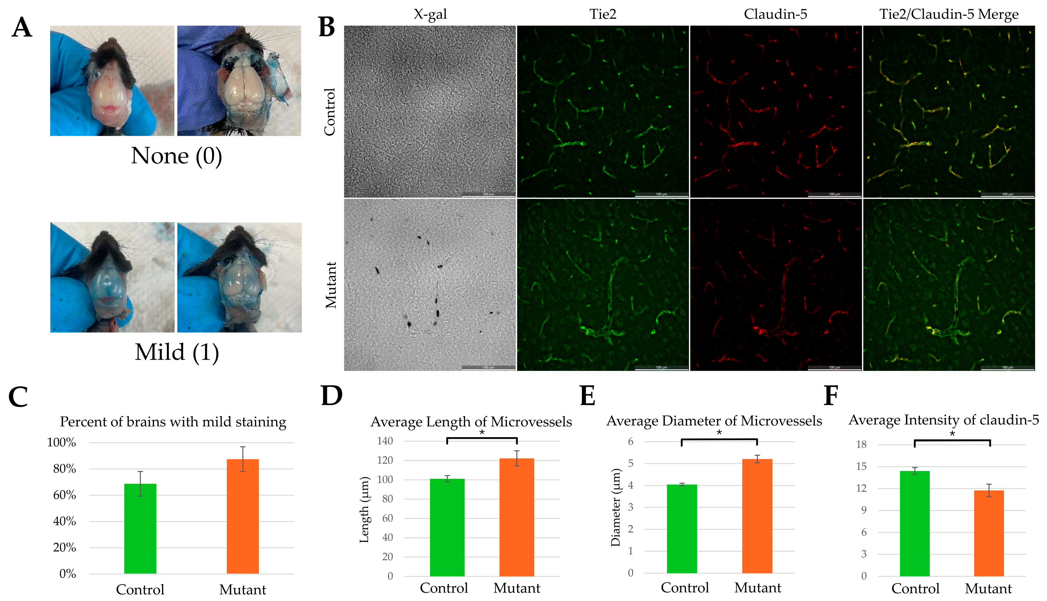 Acute Seizure Susceptibility and Chronic Vascular Malformation in a ...