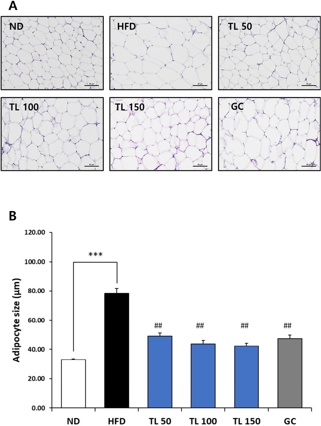 Anti-Obesity Effects of Tisochrysis lutea Powder in High-Fat Diet ...