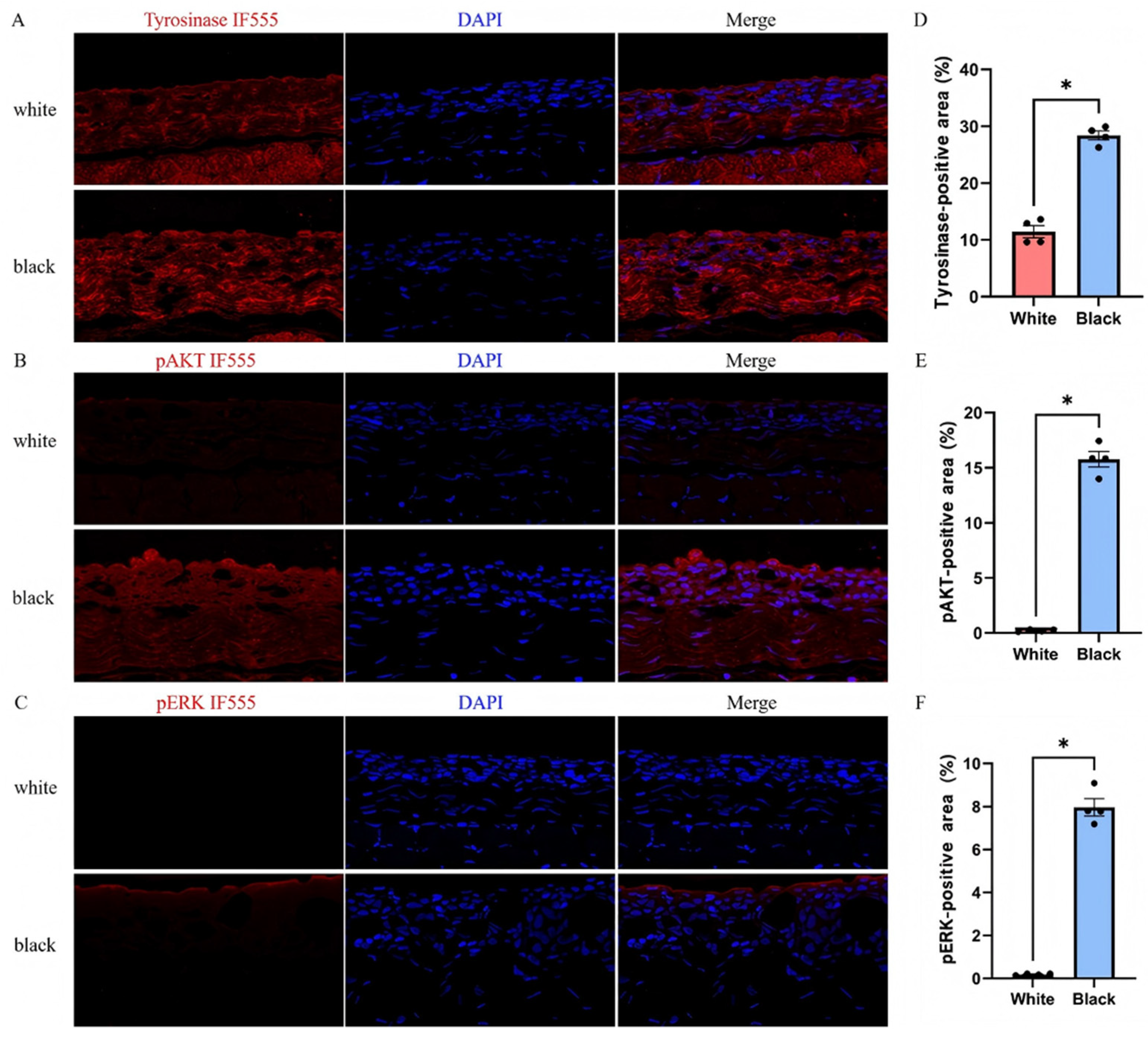 Melanin Deficiency Is Associated with Immune Homeostasis in the ...